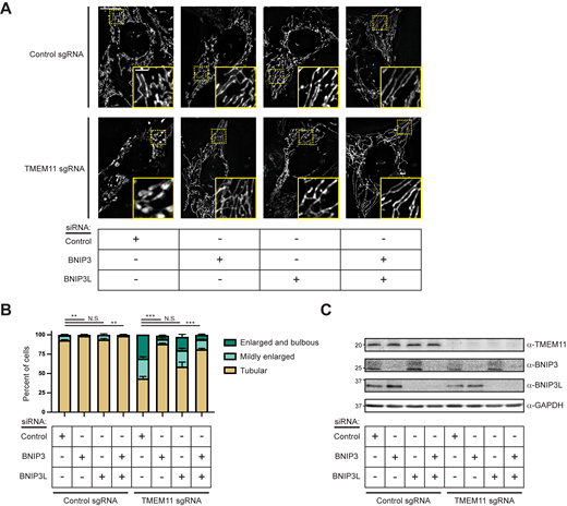 BNIP3/BNIP3L knockdown alleviates the mitochondrial morphology defects of TMEM11-depleted cells. (A) Maximum intensity projection fluorescence microscopy images are shown of U2OS CRISPRi cells stably expressing control sgRNA (top) or TMEM11 sgRNA (bottom) that were transiently transfected with the indicated siRNA and stained with Mitotracker Deep Red. Insets correspond to dotted boxes. Scale bar = 15 µm (3 µm on magnification). (B) A graph of the categorization of mitochondrial morphology from cells as in A. Data shown represent 100 cells per condition in each of three independent experiments and bars indicate SEM. Asterisks (***P < 0.001, **P < 0.01) represent unpaired two-tailed t test. N.S. indicates not statistically significant. (C) Western analysis with the indicated antibodies of whole cell lysates from cells as in A. Source data are available for this figure: SourceData F5. Refer to the image caption for details.