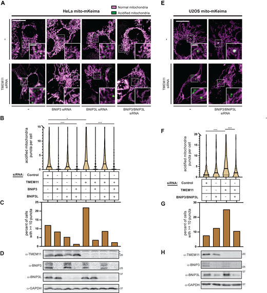 Depletion of TMEM11 increases BNIP3/BNIP3L-mediated basal mitophagy. (A and E) Merged maximum intensity projections of confocal fluorescence microscopy images of HeLa (A) or U2OS (E) mito-mKeima expressing cells that were transiently transfected with siRNAs targeting TMEM11 (bottom row) and BNIP3 and/or BNIP3L, where indicated, and excited with a 471 nm laser (magenta, neutral pH mitochondria) and a 561 nm laser (green, acidified mitochondria). Scrambled control siRNA was used in cases with no other target. Insets correspond to dotted boxes. Scale bars = 15 µm (3 µm on magnification). (B and F) Violin plots depicting the number of acidified mitochondria puncta per cell corresponding to green labeling from cells with the indicated siRNA treatments as in A and E. Data shown represent the summation of three independent experiments with 100 cells from each experiment. Asterisks (***P < 0.001, *P = 0.013) represent unpaired two-tailed t test. Bold horizontal lines mark medians and thin horizontal lines mark quartiles for each condition. For clarity, a small number of cells with high numbers of puncta are not depicted. (C and G) A histogram of the percent of cells from each condition as in B and F with at least 10 puncta. (D and H) Western analysis with the indicated antibodies of whole cell lysates from cells as in A and E treated with the indicated siRNAs. The asterisks indicate cross-reacting bands. See also Fig. S4. Source data are available for this figure: SourceData F6. Refer to the image caption for details.