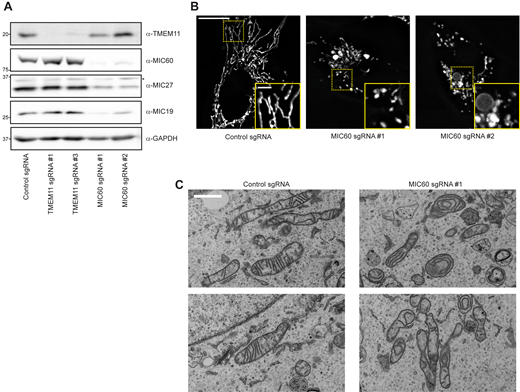 Depletion of the MICOS complex does not affect TMEM11 stability. (A) Western blot analysis of whole cell lysates from U2OS CRISPRi cells expressing scrambled control sgRNA or the indicated sgRNAs targeting TMEM11 or MIC60 and probed with the indicated antibodies. (B) Deconvolved maximum intensity projections of fluorescence microscopy images are shown of U2OS CRISPRi cells stably expressing the indicated sgRNAs and stained with Mitotracker Deep Red. Insets correspond to dotted boxes. Scale bar = 15 µm (3 µm on magnification). (C) Representative electron micrographs of mitochondria from CRISPRi cells expressing control sgRNA (left) or sgRNA targeting MIC60. Scale bar = 1 µm. Source data are available for this figure: SourceData FS1. Refer to the image caption for details.