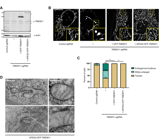 Mitochondrial morphology of TMEM11 CRISPRi cells can be rescued by reintroduction of N-terminally tagged TMEM11. (A) Western blot analysis with the indicated antibodies of whole cell lysates of CRISPRi cells expressing (left) control sgRNA or (right) TMEM11 sgRNA #3 cells that were lentivirally transduced with either GFP-TMEM11 or APEX2-GFP-TMEM11. Asterisks indicate cross-reacting bands. (B) Deconvolved fluorescence microscopy images are shown of cells as in A stained with Mitotracker Deep Red. Insets correspond to dotted boxes. Scale bar = 15 µm (3 µm on magnification). (C) A graph of the categorization of mitochondrial morphology from cells as in B. Data shown represent ∼100 cells per condition in each of three independent experiments and bars indicate SEM. Asterisks (**P < 0.01) represent unpaired two-tailed t test. (D) Additional examples of EM images from proximity labeling analysis of TMEM11 CRISPRi cells expressing APEX2-GFP-TMEM11. Enlargements (right) correspond to dotted boxes (left). Scale bar = 500 nm (200 nm on magnification). See also Fig. 3 B. Source data are available for this figure: SourceData FS3.