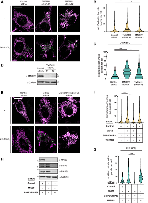 MICOS disruption leads to BNIP3/BNIP3L-mediated mitophagy. (A) Merged maximum intensity projections of confocal images of HeLa mito-mKeima expressing cells that were transiently transfected with two independent siRNAs targeting TMEM11 and excited with a 471-nm laser (magenta, neutral pH mitochondria) and a 561-nm laser (green, acidified mitochondria). The indicated cells were treated with 250 µM CoCl2 for 24 h. (B) A violin plot depicting the number of acidified mitochondria puncta per cell corresponding to green labeling from cells with the indicated siRNA treatments as in A. Data shown represent the summation of three independent experiments with 100 cells from each experiment. Asterisks (***P < 0.001, *P = 0.015) represent unpaired two-tailed t test. Bold horizontal lines mark medians and thin horizontal lines mark quartiles for each condition. (C) As in A and B for cells treated with 250 µM CoCl2 for 24 h. For clarity, a small number of cells are not depicted. (D) Western analysis with the indicated antibodies of whole cell lysates from cells as in A transfected with the indicated siRNAs. The asterisk indicates a cross-reacting band. (E–H) As in A–D for HeLa mito-mKeima cells treated with the indicated siRNAs. BNIP3/BNIP3L-silenced cells were simultaneously treated with Q-VD-OPh to prevent apoptosis. TMEM11 siRNA #1 data was collected simultaneously with Fig. S4, B and C and is redisplayed in Fig. S4, F and G for comparison. Scale bars = 15 µm. Source data are available for this figure: SourceData FS4. Refer to the image caption for details.