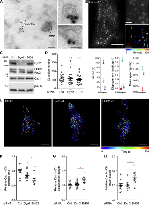 Dyn2 depletion leads to decreased PM duration and increased mobility of caveolae in Cav1-mCh FlpIn cells. (A) Immunogold staining of Dyn2 on PM lawns prepared from 3T3-L1 cells. Arrows indicate caveolae and a CCP. Panels to the right show caveolae at higher magnification. Bars, 100 nm main figure, 50 nm small panels. (B) Representative first frame image from TIRF movie of Cav1-mCh cell. Scale bar, 10 μm. Dashed white square shows the region of the cell that was tracked over 5 min. Magnifications show last frame of the movie. Scale bar, 2 μm. Red dots illustrate mCh structures recognized by the tracking program as detailed described in the Materials and methods section. The color-coded trajectories illustrate the duration and length, whereby the speed is calculated, as well as the displacement length (shortest length between the first and last position) of tracked caveolae structures for 5 min. 1 in red represents caveolae with long duration time, short displacement length, and low speed. 2 in cyan represents caveolae with intermediate duration time, long displacement length, and high speed. 3 in blue represents caveolae with short duration time, short displacement length, and high speed. (C–H) Cav1-mCh cells were transfected with siRNA for 72 h before experiments were performed. (C) Immunoblots of cells treated with siRNAs as indicated. (D) Number of caveolae counted in the basal PM in cells imaged on TIRF. Mean ± SEM from at least 17 cells per condition. (E) Color-coded trajectories of caveolae in Cav1-mCh cells treated with siRNA as indicated. Cells were imaged by TIRF over 5 min. Scale bars, 10 μm. (F–H) Quantification of Cav1-mCh track duration time (F), speed (G), and displacement length (H). Numbers were related to ctrl-treated cells. Analyses were performed using Imaris software and track mean ± SEM from at least eight cells per condition are shown. Significance was assessed using t test, *P ≤ 0.05, **P ≤ 0.01. Source data are available for this figure: SourceData F1.