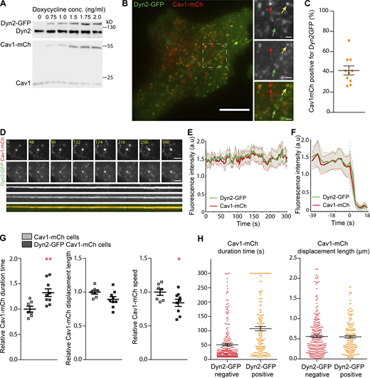 Dyn2-GFP increases PM duration of caveolae but does not influence their mobility. (A) Immunoblots of Dyn2-GFP-Cav1-mCh cells treated with concentrations of doxycycline as indicated. Doxycycline concentration used for further experiments was 1.0 ng/ml. (B) Representative image from TIRF movie of Dyn2-GFP-Cav1-mCh cell. Red arrow highlights structure only positive for Cav1-mCh, yellow arrow highlights structure positive for both Cav1-mCh and Dyn2-GFP, and green arrow highlights structures only positive for Dyn2-GFP. Scale bar, 10 and 2 μm for magnification. (C) Quantification of percentage of caveolae positive for Dyn2-GFP. Data from 10 cells are shown as scatter dot plot, mean ± SEM. (D) Top, TIRF image series of stable caveolae positive for both Cav1-mCh and Dyn2-GFP. Time in seconds as indicated. Scale bar, 2 μm. Bottom, kymograph showing stable association of Cav1-mCh and Dyn2-GFP to the plasma membrane during 300 s in TIRF movie. (E and F) Quantification of the fluorescence intensity in arbitrary units (a.u) of mCh and GFP of caveolae positive for both Cav1-mCh and Dyn2-GFP over time. (E) Fluorescence intensity from 10 stable caveolae over 300 s, mean ± SEM (shaded area). (F) Fluorescence intensity of fissioned caveolae, time point 0 s represent the last frame of caveolae before fission. Mean ± SEM (shaded area) from nine fissioned caveolae). (G) Quantification of Cav1-mCh track duration time, displacement length and mean speed in Cav1-mCh cells (gray) and Dyn2-GFP-Cav1-mCh cells (black). Analysis was performed using Imaris software, and track mean from at least 10 cells per condition is shown ± SEM. (H) Caveolae track duration times and displacement lengths divided in pools of Dyn2-GFP negative (red) or positive (orange). Dyn2-GFP-Cav1-mCh cells were imaged on TIRF over 5 min. Cav1-mCh spots were followed throughout the time series and scored whether they were positive or negative for Dyn2-GFP. Scatter dot plots show all Cav1-mCh tracks from three different cells. Analysis was performed using Imaris software, and data are shown as mean ± SEM. Significance was assessed using t test, *P ≤ 0.05, **P ≤ 0.01. Source data are available for this figure: SourceData F2. Refer to the image caption for details.