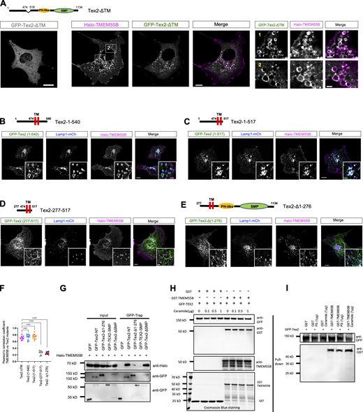 The N-terminal region of Tex2 is responsible for interacting with TMEM55B. (A) Left: representative images of COS7 cells expressing GFP-Tex2-∆TM (green) alone; middle: representative whole-cell images of a COS7 cell expressing GFP-Tex2-∆TM (green), Halo-TMEM55B (magenta), and Lamp1-mCh (blue); right: two enlarged images from the two boxed regions in the middle panel. (B–E) Representative images of COS7 cells expressing either GFP-Tex2-NT-1 (green; B), GFP-Tex2-NT-2 (green; C), GFP-Tex2 (277-517) (green; D), or GFP-Tex2-∆ (1-276) (green; E), along with Halo-TMEM55B (magenta) and Lamp1-mCh (blue) with insets. (F) Pearson’s correlation coefficient of TMEM55B vs. Tex2 mutants; Tex2-∆TM (10 cells); Tex2-1-540 (10 cells); Tex2-1-517 (10 cells); Tex2-277-517 (10 cells); and Tex2-∆1-276 (10 cells) in more than three independent experiments. Ordinary one-way ANOVA with Tukey’s multiple comparisons test. Mean ± SD. (G) GFP-Trap assays demonstrate interactions between Halo-TMEM55B and Tex2 mutants in COS7 cells. (H) Pulldown assays using GFP-Tex2 bound on GFP-Trap beads and purified GST-TMEM55B demonstrate a direct interaction in a ceramide-independent manner. (I) As in H, pulldown assays using GFP-Tex2 bound on GFP-Trap beads and purified GST-TMEM55B demonstrate a direct interaction in a PS-independent manner. Scale bar, 10 μm in the whole cell images and 2 μm in the insets in A–E. Source data are available for this figure: SourceData F3. Refer to the image caption for details.