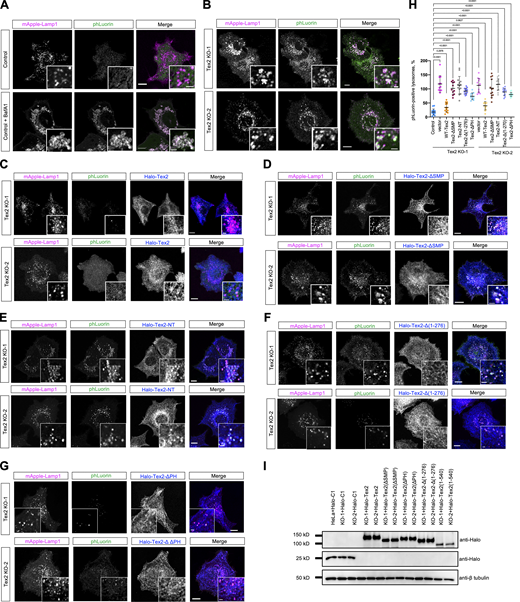 Tex2 KO affects lysosomal functions. (A and B) Representative images of control, control cells treated with BafA1 (400 nM; 2 h; A), or two HeLa Tex2-KO clones (B), expressing mApple-Lamp1-phLuorin (phLuorin in green; mApple-Lamp1 in magenta) with insets. (C–G) Representative images of two HeLa Tex2-KO clones transiently expressing either Halo-Tex2 (blue; C), Halo-Tex2-∆SMP (D), Halo-Tex2-NT (E), Halo-Tex2-∆1-276 (F), or Halo-Tex2-∆PH (G), and mApple-Lamp1-phLuorin with insets. (H) Percentage of phLuorin-positive lysosomes in control (14 cells), Tex2 KO-1 (11 cells), Tex2 KO-1 rescued by either Halo-Tex2 (13 cells), Halo-Tex2-∆SMP (11 cells), Halo-Tex2-NT (14 cells), Halo-Tex2-∆(1-276) (13 cells), or Halo-Tex2-∆PH (11 cells); and in Tex2 KO-2 (11 cells), Tex2 KO-2 rescued by either Halo-Tex2 (12 cells), Halo-Tex2-∆SMP (13 cells), Halo-Tex2-NT (14 cells), Halo-Tex2-∆(1-276) (12 cells), or Halo-Tex2-∆PH (14 cells) in more than three independent assays. Ordinary one-way ANOVA with Tukey’s multiple comparisons test. Mean ± SD. (I) Western blots demonstrate the level of Halo-Tex2 and Halo-Tex2 mutants in rescue experiments. Scale bar, 10 μm in the whole cell images and 2 μm in the insets in A–G. Source data are available for this figure: SourceData F7. Refer to the image caption for details.