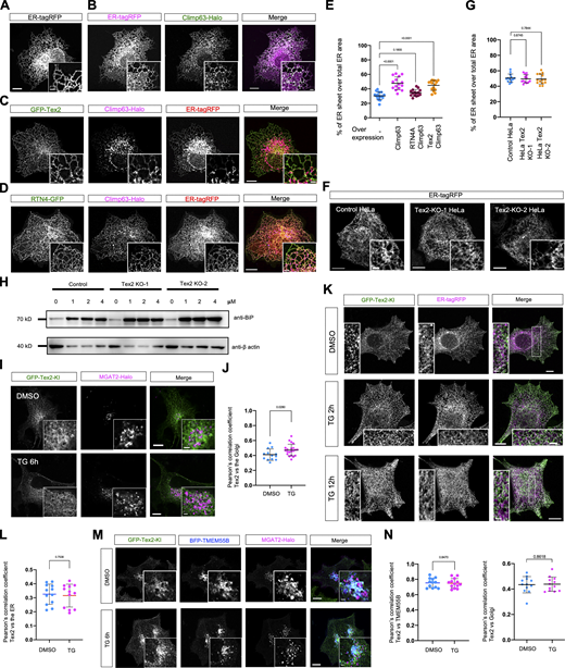 Supplementary data toFigs. 1 and 2. (A–D). Representative images of COS7 cells expressing the general ER luminal marker ER-tagRFP alone (A), Climp63-Halo (green) and ER-tagRFP (magenta; B), Climp63-Halo (magenta) and GFP-Tex2 (green; C), or Climp63-Halo (magenta) and RTN4-GFP (green; D) with insets at cell periphery. (E) Quantification of ER sheet abundance in A–D. 16 COS7 cells expressing ER-tagRFP, 15 cells expressing Climp63-Halo and ER-tagRFP, 15 cells expressing Climp63-Halo and GFP-Tex2, and 15 cells expressing Climp63-Halo and RTN4-GFP from three independent assays were analyzed. Ordinary one-way ANOVA with Tukey’s multiple comparisons test. Mean ± SD. (F) Representative images of control, or two HeLa Tex2-KO clones expressing ER-tagRFP (magenta) with insets at the cell periphery. (G) Quantification of ER sheet abundance in F. 13 control HeLa cells, 13 Tex2 KO-1 cells, and 14 Tex2 KO-2 cells from three independent assays were analyzed. Ordinary one-way ANOVA with Tukey’s multiple comparisons test. Mean ± SD. (H) Western blots demonstrate the increase in BiP level in control or two Tex2-KO clones upon TG stimulation for 12 h. (I) Representative images of a GFP-Tex2-KI (green) cell expressing a Golgi marker MGAT2-Halo (magenta) upon DMSO and TG (12 h) with insets. (J) Pearson’s correlation coefficient of GFP-Tex2 vs. MGAT2-Halo in DMSO (13 cells) or TG-treated cell (21 cells). Two-tailed unpaired Student’s t test. Mean ± SD. (K) Representative images of a GFP-Tex2-KI (green) cell expressing ER-tagRFP (magenta) upon DMSO, TG (2 h), or TG (12 h), with insets. (L) Pearson’s correlation coefficient of GFP-Tex2 vs. ER-tagRFP in DMSO (12 cells) or TG-treated cell (12 h; 12 cells). Two-tailed unpaired Student’s t test. Mean ± SD. (M) Representative images of a GFP-Tex2-KI (green) cell expressing BFP-TMEM55B (blue) and MGAT2-Halo (magenta) upon DMSO or TG treatment for 6 h with insets. (N) Left: Pearson’s correlation coefficient of GFP-Tex2 vs. Halo-TMEM55B in DMSO (12 cells) or TG-treated cell (13 cells). Right: Pearson’s correlation coefficient of GFP-Tex2 vs. MGAT2-Halo in DMSO (12 cells) or TG-treated cell (13 cells) from more than three independent assays. Two-tailed unpaired Student’s t test. Mean ± SD. Scale bar, 10 μm in the whole cell images and 2 μm in the insets in A–D, F, I, K, and M. Source data are available for this figure: SourceData FS3.