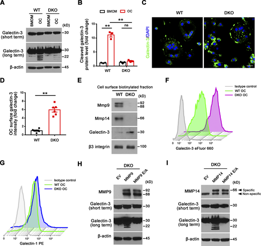 Mmp9/Mmp14 regulates galectin-3 lattice remodeling in osteoclasts. (A and B) Galectin-3 expression and cleavage as assessed with anti–galectin-3 monoclonal antibody (ab2785; Abcam; epitopes mapped against N-terminal region) by Western blot (A) and quantification (B) in BMDMs and osteoclasts (OC) generated from wild-type or DKO mice. Data are presented as mean ± SEM (n = 3 biological replicates). (C and D) Galectin-3 (green) immunofluorescence of non-permeabilized wild-type or DKO osteoclasts stained with an anti–galectin-3 monoclonal antibody (#125401; Biolegend; clone M3/38, epitopes mapped against N-terminal region; C), and surface galectin-3 level quantified (D). Scale bar, 20 μm. Data are presented as mean ± SEM (n = 3 biological replicates with two technical replicates each). (E) Following cell surface biotinylation and capture with streptavidin magnetic beads, Mmp9, Mmp14, galectin-3, and β3 integrin expression in the membrane fraction of wild-type and DKO osteoclasts as assessed by Western blot. Results are representative of three independent experiments. (F) Measurements of surface galectin-3 in wild-type and DKO osteoclasts with eFluor 660–conjugated anti–galectin-3 monoclonal antibody (#50-5301-82; Thermo Fisher Scientific; clone M3/38, epitopes mapped within the N-terminal domain) by flow cytometry. Results are representative of three independent experiments. (G) Measurements of surface galectin-1 in wild-type and DKO osteoclasts by flow cytometry. Results are representative of three independent experiments. (H) DKO BMDMs were transduced with lentiviral vectors expressing full-length MMP9, an MMP9E/A mutant, or an empty control, and differentiated into osteoclasts. Cell lysates were collected for MMP9 and galectin-3 expression and cleavage as assessed by Western blot. Results are representative of three independent experiments. (I) DKO BMDMs were transduced with lentiviral vectors expressing full-length MMP14, MMP14E/A, or an empty control and differentiated into osteoclasts. Cell lysates were collected for MMP14 and galectin-3 expression and cleavage as assessed by Western blot. Results are representative of three independent experiments. **P < 0.01. Statistical significance was assessed using two-way ANOVA with Bonferroni correction (B) and unpaired two-sided Student’s t test (D). Source data are available for this figure: SourceData F4.