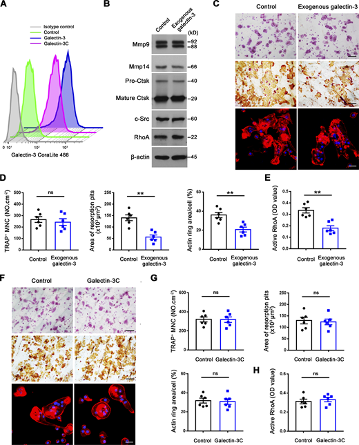 Exogenous galectin-3, but not galectin-3C, regulates osteoclast RhoA GTPase activation, sealing zone formation and bone resorptive activity. (A) Surface galectin-3 levels in wild-type osteoclasts exogenously treated with 0.1 μM galectin-3 or galectin-3C (corresponds to amino acids 108–250 containing the C-terminal carbohydrate recognition domain of galectin-3) for 30 min at 37°C (John et al., 2003; Massa et al., 1993), followed by staining with the CoraLite 488–conjugated galectin-3 polyclonal antibody (CL488-14979; Proteintech; epitopes mapped against full-length) as detected by flow cytometry. Results are representative of three independent experiments. (B) Mmp9, Mmp14, Ctsk, c-Src, and RhoA expression in wild-type osteoclasts treated with exogenous 0.1 μM galectin-3 as assessed by Western blot. Results are representative of three independent experiments. (C and D) TRAP (red), WGA-DAB, and phalloidin staining (red) of wild-type pre-osteoclasts cultured atop bone slices in the presence of exogenous 0.1 μM galectin-3 for 3 d at 37°C (C), with the number of TRAP+ MNCs, resorption pit area, and actin ring area per cell quantified (D). Scale bar, upper and middle 100 μm, lower 20 μm. Data are presented as mean ± SEM (n = 6 biological replicates). (E) Wild-type osteoclasts were cultured and treated with exogenous 0.1 μM galectin-3 for 2 h at 37°C and RhoA activity determined upon activation with 20 ng/ml M-CSF and 30 ng/ml RANKL for 15 min. Data are presented as mean ± SEM (n = 6 biological replicates). (F and G) Wild-type pre-osteoclasts were cultured atop bone slices and treated with exogenous 0.1 μM galectin-3C for 3 d at 37°C (John et al., 2003; Massa et al., 1993). The number of TRAP+ MNCs, resorption pit area, and actin ring area per cell were quantified (G) following TRAP, WGA-DAB, and phalloidin staining (red) (F), respectively. Scale bar, upper and middle 100 μm, lower 20 μm. Data are presented as mean ± SEM (n = 6 biological replicates). (H) Wild-type osteoclasts were cultured and treated with exogenous 0.1 μM galectin-3C for 2 h at 37°C and RhoA activity determined upon activation with 20 ng/ml M-CSF and 30 ng/ml RANKL for 15 min. Data are presented as mean ± SEM (n = 6 biological replicates). **P < 0.01. Statistical significance was assessed using unpaired two-sided Student’s t test. Source data are available for this figure: SourceData F5. Refer to the image caption for details.