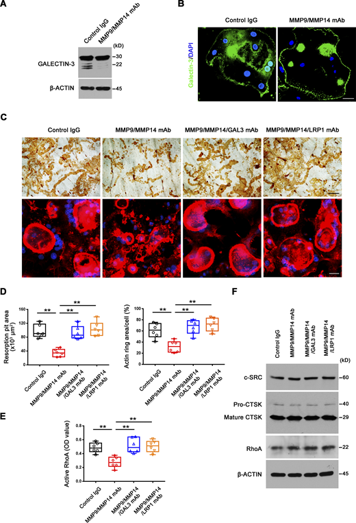 MMP9/MMP14–GALECTIN-3–LRP1 axis regulates human osteoclast activity. (A) GALECTIN-3 expression and cleavage as assessed with anti–galectin-3 monoclonal antibody (ab2785; Abcam; epitopes mapped against N-terminal region) by Western blot in human osteoclasts cultured in the presence or absence of MMP9 and MMP14 function-blocking mAbs. Results are representative of three independent experiments. (B) GALECTIN-3 (green) immunofluorescence stained with an anti-galectin-3 monoclonal antibody (#125401; Biolegend; clone M3/38, epitopes mapped against N-terminal region) of non-permeabilized human osteoclasts differentiated from macrophages with M-CSF/RANKL for 9 d at 37°C in the presence or absence of MMP9 and MMP14 function-blocking antibodies. Scale bar, 20 μm. Results are representative of three independent experiments. (C and D) Osteoclastic resorption pits and phalloidin staining (red) of human osteoclasts cultured atop bone slices with MMP9 and MMP14 function-blocking mAbs in the presence or absence of a GALECTIN-3 function-blocking mAb (GAL3 mAb) or LRP1 function-blocking mAb (25 μg/ml) for 9 d at 37°C (C) with resorption pit and actin ring areas quantified (D). Scale bar, upper 100 μm, lower 20 μm. Data are presented as mean ± SEM (n = 6 biological replicates). (E) Human osteoclasts were differentiated from macrophages with M-CSF/RANKL for 9 d in the presence or absence of MMP9 and MMP14 function-blocking mAbs with or without GAL3 mAb or LRP1 function-blocking mAb at 25 μg/ml, and RhoA activity determined upon activation with 20 ng/ml M-CSF and 20 ng/ml RANKL for 15 min. Data are presented as mean ± SEM (n = 6 biological replicates). (F) c-Src, Ctsk, and RhoA expression in human osteoclasts differentiated from macrophages with M-CSF/RANKL for 9 d in the presence or absence of MMP9 and MMP14 function-blocking mAbs with or without GAL3 mAb or LRP1 function-blocking mAb (25 μg/ml) as assessed by Western blot. Results are representative of three independent experiments. **P < 0.01. Statistical significance was assessed using one-way ANOVA with Bonferroni correction. Source data are available for this figure: SourceData F9. Refer to the image caption for details.