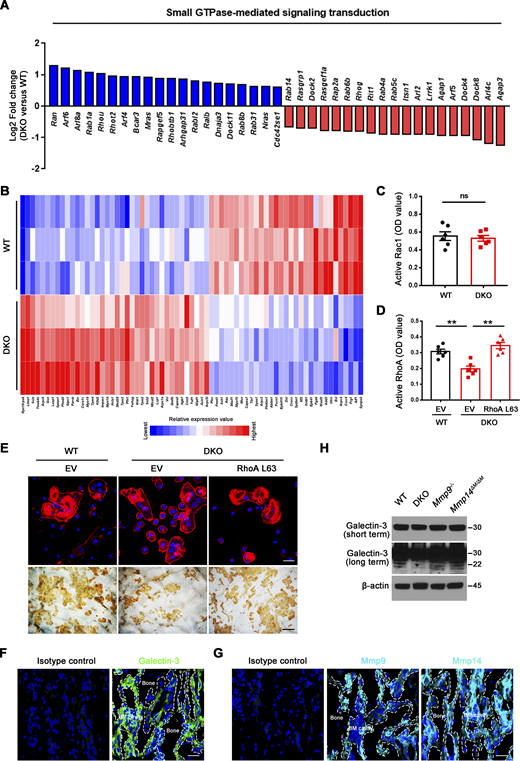 Active RhoA rescues defects in sealing zone formation and bone resorption in DKO osteoclasts. (A) Relative expression levels of small GTPase-mediated signal transduction-related transcripts retrieved from DAVID GO categories were assessed in DKO osteoclasts as compared with wild-type osteoclasts (normalized to 1; n = 3). (B) The differentially expressed transcripts of cytoskeleton-associated pathways in DKO osteoclasts as compared with wild-type osteoclasts are presented (n = 3; color bar, relative expression value). (C) Rac1 activity of wild-type and DKO osteoclasts cultured on plastic upon activation with 20 ng/ml M-CSF and 30 ng/ml RANKL for 15 min. Data are presented as mean ± SEM (n = 6 biological replicates). (D) EV-transduced wild-type BMDMS, and EV- or ca-RhoA–transduced DKO BMDMs were differentiated into osteoclasts on plastic, and RhoA activity determined upon activation 20 ng/ml M-CSF and 30 ng/ml RANKL for 15 min. Data are presented as mean ± SEM (n = 6 biological replicates). (E) EV-transduced wild-type pre-osteoclasts, and EV- or ca-RhoA–transduced DKO pre-osteoclasts were cultured atop bone slices for 3 d and stained with phalloidin (red). Osteoclasts were removed and resorption pits visualized by WGA-DAB staining (n = 6 biological replicates). Scale bar, upper 20 μm, lower 100 μm. (F and G) Immunofluorescence staining of a femur section from a wild-type mouse with anti-galectin-3 (#125401; Biolegend; clone M3/38; F; green), anti-Mmp9, anti-Mmp14 antibodies (G; cyan), or corresponding isotype controls. BM cavity, bone marrow cavity. Scale bar, 30 μm. Results are representative of three independent experiments. (H) Galectin-3 expression and cleavage as assessed by Western blot in osteoclasts generated from wild-type, Mmp9−/−, Mmp14ΔM/ΔM, or DKO mice. Results are representative of three independent experiments. **P < 0.01. Statistical significance was assessed using unpaired two-sided Student’s t test (C) and one-way ANOVA with Bonferroni correction (D). Source data are available for this figure: SourceData FS3. Refer to the image caption for details.