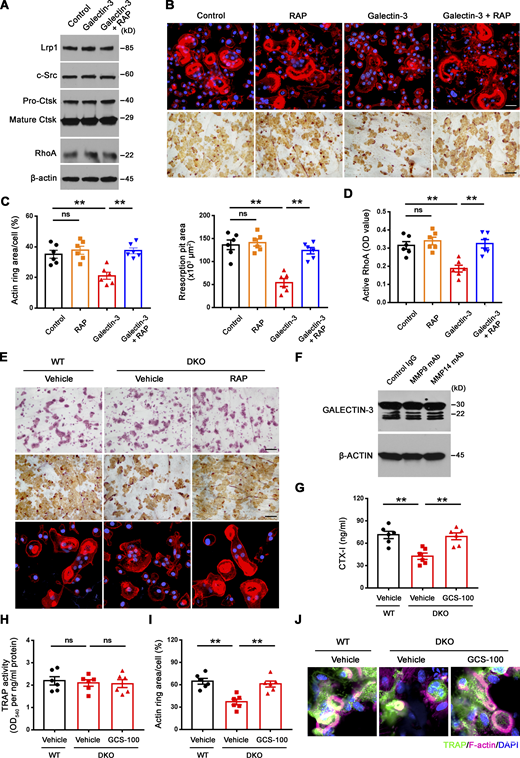 A galectin-3–Lrp1 axis regulates RhoA activation and sealing zone formation in osteoclasts. (A) Lrp1, c-Src, Ctsk, and RhoA expression in wild-type osteoclasts differentiated and treated with exogenous 0.1 μM galectin-3 in the presence or absence of 50 nM RAP for 5 d at 37°C as assessed by Western blot. Results are representative of three independent experiments. (B and C) Phalloidin (red) and WGA-DAB staining of wild-type pre-osteoclasts cultured atop bone slices treated with exogenous 0.1 μM galectin-3 in the presence or absence of 50 nM RAP for 3 d at 37°C (B), and actin ring area per cell and resorption pit area quantified (C). Scale bar, upper 20 μm, lower 100 μm. Data are presented as mean ± SEM (n = 6 biological replicates). (D) Wild-type osteoclasts were cultured and treated with exogenous 0.1 μM galectin-3 in the presence or absence of 50 nM RAP for 2 h at 37°C, and RhoA activity determined upon activation with 20 ng/ml M-CSF and 30 ng/ml RANKL for 15 min. Data are presented as mean ± SEM (n = 6 biological replicates). (E) TRAP (red), WGA-DAB, and phalloidin staining (red) of wild-type pre-osteoclasts cultured atop bone slices treated with vehicle, and DKO osteoclasts treated with vehicle or 50 nM RAP for 3 d at 37°C (n = 6 biological replicates). Scale bar, upper and middle 100 μm, lower 20 μm. (F) GALECTIN-3 expression and cleavage as assessed by Western blot in human osteoclasts differentiated from macrophages in the presence or absence of either an MMP9 function-blocking mAb (25 μg/ml) or MMP14 function-blocking antibody (DX-2400; 100 μg/ml). Results are representative of three independent experiments. (G and H) Calvaria isolated from wild-type and DKO mice were cultured in the presence or absence of 20 μg/ml GCS-100 for 5 d at 37°C, and supernatants or whole cell lysates collected for CTX-I ELISA (G) and TRAP activity (H), respectively. Data are presented as mean ± SEM (n = 6 biological replicates). (I and J) Actin ring area per cell (I) and phalloidin staining (magenta) with TRAP (green) immunofluorescence (J) are shown of wild-type and DKO calvaria explants cultured in the presence or absence of 20 μg/ml GCS-100 for 5 d at 37°C. Scale bar, 10 μm. Data are presented as mean ± SEM (n = 6 biological replicates). **P < 0.01. Statistical significance assessed using one-way ANOVA with Bonferroni correction. Source data are available for this figure: SourceData FS5. Refer to the image caption for details.