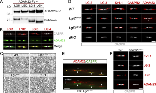 LGI2 and LGI3 are ligands for ADAM23 at the JXP and play a role in localization of Kv1 channels in myelinated axons. (A) Western blot (WB) on tissue culture supernatants following co-transfection of HEK293T cells with ADAM23-Fc and one of the four LGI proteins. ADAM23-Fc (top) was precipitated from media with ProtA beads, co-precipitating interacting LGI proteins (bottom, pulldown). (B) IHC showing which of the LGI proteins are present at the JXP along with ADAM23. Adult WT teased sciatic nerve immunolabeled with CASPR (gray) LGI1, 2, 3, or 4 (red) and ADAM23 (green). Scale bar = 10 µm. (C) Semi-thin images of paraphenylenediamine-stained cross sections of sciatic nerves from WT, Lgi3Δ1/Δ1, Lgi2Δ1/Δ1, and double Lgi2Δ1/Δ1 and Lgi3Δ1/Δ1 knock-out (dKO) adult mice. Scale bar = 10 µm. (D) IHC on teased sciatic nerve fibers from P12 mice. WT tissue staining shown as a positive control (top) followed by images from mice lacking the expression of Lgi2 (Lgi2Δ1/Δ1), Lgi3 (Lgi3Δ1/Δ1), or both Lgi2 and Lgi3 (double knock-out - dKO). All images include the paranodal CASPR staining (gray) and one of the following: LGI2, LGI3, Kv1.1, CASPR2, and ADAM23 (red). Scale bar = 5 µm. (E) IHC on teased sciatic nerve from an adult (P30) Lgi3Δ1/Δ1 mouse, stained with antibodies against CASPR (green) and ADAM23 (red). Top image is a merge of both channels whereas bottom image represents split, horizontally shifted signals to indicate mislocalization of ADAM23 and its invasion of the paranodal region in the absence of LGI3 in an adult mouse. Scale bar = 10 µm. (F) Examination of LGI2 and LGI3 expression at the JXP in WT (left) and Adam23∆1/∆1 (right) P10 mice through IHC on teased sciatic nerve. All images show CASPR (gray) staining and Kv1.1, LGI2, LGI3, or ADAM23 (red). Scale bar = 5 µm. Source data are available for this figure: SourceData F2.
