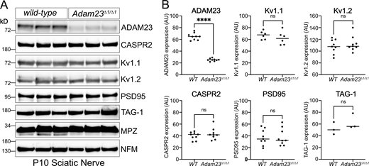 Axonal expression levels of Kv1 complex proteins in the absence of ADAM23. (A) Representative Western blot results from homogenized sciatic nerves of P10 WT (Adam23+/+) and Adam23Δ1/Δ1 mice. Each lane represents a pair of sciatic nerves from one mouse. All experiments were performed in triplicate (three biological replicates per genotype per blot). Staining includes ADAM23, CASPR2, Kv1.1, Kv1.2, PSD95, TAG-1, P0 (MPZ), and Neurofilament (NFM). (B) Band density for each protein was normalized against P0 and graphed depending on genotype. Each dot represents one mouse, i.e., one pair of sciatic nerves. ADAM23 n = 9, Kv1.1 n = 6, Kv1.2 n = 9, CASPR2 n = 9, PSD95 n = 9 and TAG-1 n = 3. Unpaired t test was carried out to determine statistical significance of the results. ADAM23, F (8, 8) = 7.0, ****P < 0.0001; Kv1.1, F (5, 5) = 2.6, P = 0.37; Kv1.2, F (8, 8) = 1.2, P = 0.47; CASPR2, F (8, 8) = 2.3, P = 0.41; PSD95, F (8, 8) = 1.2, P = 0.98; TAG-1, F (8, 8) = 1.6, P = 0.33. Source data are available for this figure: SourceData F5.