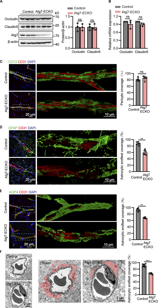 Detachment of astrocytic endfeet from cerebral microvessels in mice with endothelial deletion of Atg7. (A) The brain microvessel lysate were obtained from Atg7-ECKO mice, with wild-type littermate as control. The expression of occludin and claudin-5 were analyzed by Western blot, with β-actin as an internal loading control. The band densities were quantified by ImageJ software and normalized to the control. Data were shown as mean ± SD (n = 3). The ns represents no statistical significance. Unpaired two-tailed Student’s t test for comparison of two groups. (B) Brain microvessels were isolated from Atg7-ECKO mice, with wild-type littermate as control. The mRNA levels of occludin and claudin-5 were analyzed by RT-qPCR, with β-actin used as an internal control. Data were shown as the mean ± SD (n = 3). The ns represents no statistical significance. Unpaired two-tailed Student’s t test for comparison of two groups. (C) The brain slices were prepared from the Atg7-ECKO mice, with wild-type littermate as control. Immunostaining was performed with the antibodies against CD13 (green, a pericyte marker) and CD31 (red). DAPI (blue) was used for counterstaining. The stained slices were mounted and visualized by z-stack confocal imaging with 63× objective. The representative images of the cortex were presented (left). The zoomed-in views (middle) show the 3D reconstruction of CD13+ pericytes (green) covering CD31+ vessels (red). The pericyte coverage along the vessels was quantified by dividing the total area of the vessels by the area of the pericyte in contact with the vessels (right). For quantifications, 30 vessels from five mice were analyzed in each group (right). Data were shown as mean ± SD (n = 5). The ns represents no statistical significance. Unpaired two-tailed Student’s t test for comparison of two groups. (D and E) Similar experiments were performed as in C, except that the CD13 antibody was replaced by GFAP (astrocyte marker; D) or AQP4 (astrocytic endfeet marker; E). For quantifications, 30 vessels from six or four mice were analyzed in each group. Data were shown as mean ± SD (n = 6, D; n = 4, E). **, P < 0.01. Unpaired two-tailed Student’s t test for comparison of two groups. (F) The brain cortex samples from the Atg7-ECKO mice were subjected to TEM analysis, with wild-type littermate as control. Representative electron micrograph of perivascular astrocytes was provided (left). The zoomed-in views (middle) show astrocytic endfeet (shaded in red) covering vessels. L, the lumen of the blood microvessels. The astrocytic endfeet coverage around the vessels was calculated as the length of the lumen in contact with the red shaded part divided by the total length of the lumen (right). For quantifications, 30 vessels from six mice were analyzed in each group (right). Data were shown as mean ± SD (n = 6). ***, P < 0.001. Unpaired two-tailed Student’s t test for comparison of two groups. Source data are available for this figure: SourceData F2. Refer to the image caption for details.