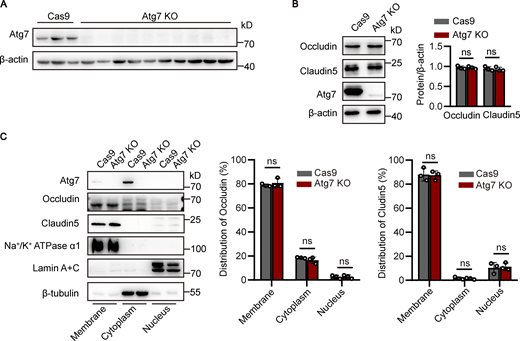 Atg7 deletion in HBMECs reduces the expression of fibronectin but not occludin and claudin-5. (A) Atg7-knockout (KO) of HBMECs were constructed using CRISPR/Cas9-mediated genome editing in vitro. HBMECs were infected by lentivirus containing the cDNA of Cas9 together with sgRNA targeting the first exon of Atg7. 48 h after infection, blasticidin (3 μg/ml) and puromycin (1 μg/ml) were used for screening of positive infected cells. The cells were collected for protein extraction, and Western blot was performed to detect the knockout effect of Atg7 in HBMECs. Lentivirus containing the cDNA of Cas9 alone was used as a control. (B) The cells were lysed, and Western blot was performed to determine the protein levels of occludin and claudin-5 in Atg7 KO HBMECs, with HBMECs transfected with Cas9 alone as control. β-Actin was used as an internal loading control. The band densities were quantified by ImageJ software and normalized to the control. Data were shown as mean ± SD (n = 3). The ns represents no statistical significance. Unpaired two-tailed Student’s t test for comparison of two groups. (C) The subcellular fractions, including membrane, cytoplasm, and nucleus fractions, were extracted from the Atg7-KO HBMECs and the control cells using the Minute Plasma Membrane Protein Isolation and Cell Fractionation Kit (Invent Biotechnologies) according to the manufacturer’s instructions. Western blot was performed to determine subcellular distribution of occludin and claudin-5 in the cells. Na+/K+ ATPase α1, lamin A+C, and β-tubulin were detected as the marker for membrane, cytoplasm, and nucleus, respectively. The band densities were quantified by ImageJ software. The distribution of occludin and claudin-5 in each fraction was calculated as the percentage of total. Data were shown as mean ± SD (n = 3). The ns represents no statistical significance. Unpaired two-tailed Student’s t test for comparison of two groups. Source data are available for this figure: SourceData FS2.