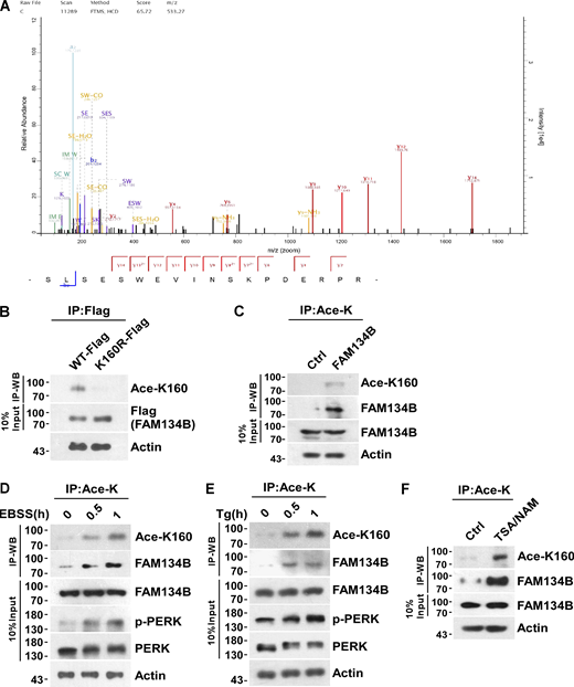 FAM134B is acetylated at lysine160 (K160), which is responsive to ER stress. (A) Representative MS/MS spectrum of acetylated peptide 149SLSESWEVINSK(Ace)PDERPR166 (m/z = 533.27, MH44+), which was acetylated at lysine160 (K160) of FAM134B. (B) Specificity verification of recognizing FAM134B K160 acetylation (~70 kD). Mutation of lysine (K) to arginine (R) mimicking deacetylation, which abolished recognition by Ace-K160) antibodies. HEK293T cells were transfected with FAM134B-Flag. IP was performed with anti-Flag beads. FAM134B K160 acetylation was analyzed by Western blot (WB) with Ace-K160 antibodies. (C) K160 acetylation of endogenous FAM134B. IP was performed with an antibody to acetylated lysine. The control was the Protein A/G agarose resin without the antibody that can recognize acetylated FAM134B. K160 acetylation and FAM134B were detected by Western blot. (D and E) K160 acetylation of endogenous FAM134B in response to ER stress. HEK293T cells were treated with EBSS starvation medium or 1 μM of Tg to trigger ER stress for 0, 0.5, 1 h. IP was performed with an antibody to acetylated lysine. K160 acetylation, FAM134B, p-PERK, and PERK were detected by Western blot. (F) K160 acetylation of endogenous FAM134B increased by treatment with deacetylase inhibitors. HEK293T cells were treated with deacetylase inhibitors TSA (1 mM) and NAM (5 mM) for 12 h. The control was treated with DMSO. IP was performed with an antibody to acetylated lysine. K160 acetylation and FAM134B were detected by Western blot. Molecular weight measurements are in kD. Source data are available for this figure: SourceData F1. Refer to the image caption for details.