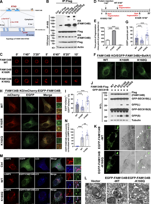 FAM134B acetylation dramatically enhances FAM134B oligomerization to induce ER fragmentation and ER-phagy. (A) Topology of FAM134B. Schematic of the full-length FAM134B; K160 resides in the RTND of FAM134B. CAMK2B-mediated FAM134B S151 phosphorylation, which further enhanced FAM134B8 oligomerization, ER fragmentation, and ER-phagy. G216R, a type II HSAN patient-derived FAM134B variant, exhibits hyperactive in FAM134B oligomerization, ER fragmentation, and ER-phagy. TM: transmembrane. (B) Comparison of self-interaction of FAM134B mutants using co-IP. Mimicking dephosphorylation by SA and deacetylation by K160R reduced FAM134B self-interaction. Mimicking permanent phosphorylation by SD enhanced FAM134B self-interaction. K160Q which mimicking permanent acetylation and G216R dramatically enhanced FAM134B self-interaction and oligomerization. HEK293T cells were transfected with mutants of HA-FAM134B and FAM134B-Flag. IP was performed with anti-Flag beads. The indicated proteins were detected by Western blot (WB). SA: mutanting Serine into Alanine. SD: mutanting Serine into Aspartic acid. (C–E) Acetylation of FAM134B enhanced liposome fragmentation in vitro. After injecting recombinant protein (25 μg) into the chamber (500 μl), the morphological changes of liposomes were monitored by live imaging for 20 min. The images at different time points as indicated were presented. The time required for liposome fragmentation was quantified in E (n = 3 experimental replicates). Scale bars, 10 μm. Data are shown as means ± SEM and analyzed with one-way ANOVA. ***P < 0.001. (F and G) FAM134B K160Q enhanced ER membrane fragmentation. FAM134B KO U2OS cells were engineered to inducibly express EGFP-FAM134B (WT), EGFP-FAM134B (K160R), or EGFP-FAM134B (K160Q) at endogenous levels. Lysosomal degradation of EGFP-FAM134B was blocked by 10 nM BafA1 for 2 h. EGFP-positive puncta were quantified in G (n = 30 cells per group). Scale bars, 10 µm. Data are shown as means ± SEM and analyzed with one-way ANOVA. ***P < 0.001. (H and I) FAM134B K160Q enhanced ER-phagy. FAM134B KO U2OS cells were engineered to inducibly express mCherry-EGFP-FAM134B (WT), mCherry-EGFP-FAM134B (K160R), or mCherry-EGFP-FAM134B (K160Q) at endogenous levels. MCherry-positive but EGFP-negative puncta were quantified in I (n = 30 cells per group). Scale bars, 10 µm. The scale bars in the magnification boxes are 2 µm. Data are shown as means ± SEM and analyzed with one-way ANOVA. ***P < 0.001. (J) Lysosomal cleavage of GFP was analyzed by Western blot for U2OS cells transfected with 1.5 μg GFP-SEC61B and 0.5 μg FAM134B-Flag mutants. WCL: whole-cell lysate. (K) Analysis of FAM134B-mediated ER membrane fragmentation by CLEM. U2OS cells grown on glass gridded coverslips were transfected with EGFP-FAM134B and imaged by Zeiss Airyscan to collect light microscopy images. Samples were then prepared for imaging by FIB-SEM. Light and electron microscope images were superimposed. Scale bars, 10 μm. (L) Analysis of FAM134B-mediated ER membrane fragmentation by IEM. U2OS cells were transfected with EGFP-FAM134B. White arrowheads indicated that the ER sheet labeled by immuno-gold was wrapped by autophagosomes. Scale bar, 200 nm. (M and N) FAM134B was colocalized with LAMP2 and LC3. U2OS cells transfected with EGFP-FAM134B were stained for endogenous LAMP2 and LC3. Lysosomal degradation of EGFP-FAM134B was blocked by 10 nM BafA1 for 2 h. EGFP-positive puncta were quantified in N (n = 20 cells per group). Scale bars, 10 µm. The scale bars in the magnification boxes are 2 µm. Data are shown as means ± SEM and analyzed with one-way ANOVA. **P < 0.01, ***P < 0.001. Molecular weight measurements are in kD. Source data are available for this figure: SourceData F2.