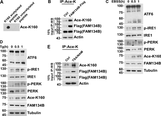 Acetylation of FAM134B K160 is responsive to ER stress. (A) The reliability of FAM134B K160 acetylation antibody was validated by performing a dot blot assay using synthesized acetyl-peptide (C)WEVINSK(Ac)PDER-NH2 (amino acids 154–164, NP_001030023.1) and the control unacetylated peptide (C)WEVINSKPDER-NH2. (B) K160 acetylation of FAM134B in FAM134B-Flag stable cell line. IP was performed with an antibody to acetylated lysine. The control was the Protein A/G agarose resin without the antibody that can recognize acetylated FAM134B. K160 acetylation and Flag were detected by Western blot (WB). (C and D) ER stress markers including ATF6, p-IRE1, and p-PERK were response to EBSS or Tg treatment. HEK293T cells were treated with EBSS or Tg (1 μM) to trigger ER stress for 0, 0.5, 1 h. The indicated proteins were detected by Western blot. (E) K160 acetylation of FAM134B in FAM134B-Flag stable cell line increased by treated with deacetylase inhibitors. Cells were treated with deacetylase inhibitors TSA (1 mM) and NAM (5 mM) for 12 h. The control was treated with DMSO. IP was performed with an antibody to acetylated lysine. K160 acetylation and Flag were detected by Western blot. Molecular weight measurements are in kD. Source data are available for this figure: SourceData FS1. Refer to the image caption for details.