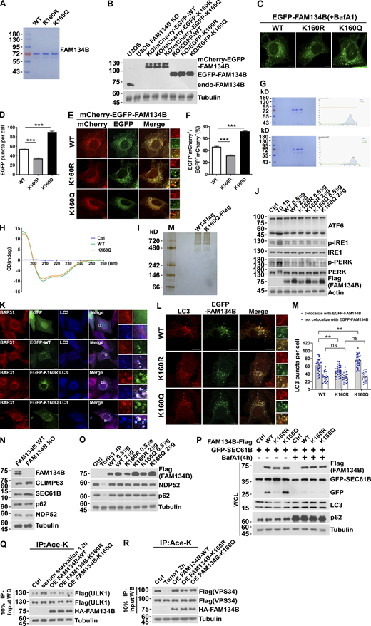 FAM134B acetylation dramatically enhances FAM134B oligomerization to induce ER fragmentation and ER-phagy. (A) Purified recombinant protein FAM134B for in vitro liposome fragmentation assay (Fig. 2 C). (B) Induction of expression of mCherry-EGFP-FAM134B or EGFP-FAM134B to endogenous levels. Construction of mCherry-EGFP-FAM134B or EGFP-FAM134B inducible cell line in FAM134B KO U2OS cells. Cells were induced with 0.5 µg Doxycycline for 24 h. Western blot was performed using anti-FAM134B antibody. (C and D) FAM134B K160Q enhanced ER membrane fragmentation. U2OS cells transiently expressed 0.2 µg EGFP-FAM134B (WT), EGFP-FAM134B (K160R), or EGFP-FAM134B (K160Q). Lysosomal degradation of EGFP-FAM134B was blocked by 10 nM BafA1 for 2 h. EGFP-positive puncta were quantified in D (n = 30 cells per group). Scale bars, 10 µm. Data are shown as means ± SEM and analyzed with one-way ANOVA. ***P < 0.001. (E and F) FAM134B K160Q enhanced ER-phagy. U2OS cells transiently expressed 0.2 µg mCherry-EGFP-FAM134B (WT), mCherry-EGFP-FAM134B (K160R), or mCherry-EGFP-FAM134B (K160Q). MCherry-positive but EGFP-negative puncta were quantified for in F (n = 30 cells per group). Scale bars, 10 µm. The scale bars in the magnification boxes are 2 µm. Data are shown as means ± SEM and analyzed with one-way ANOVA. ***P < 0.001. (G) Analysis of the oligomer size of recombinant FAM134B protein (WT and K160Q) using Superose6 SEC. (H) Analysis of the secondary structure of FAM134B protein by circular dichroism assay. FAM134B-WT and FAM134B-K160Q protein at peaks collected by SEC were analyzed by circular dichroism (JASCO, J-1500-150ST). (I) Analysis of the oligomer size of FAM134B (WT and K160Q) using native PAGE. FAM134B-Flag purified from HEK293T was eluted with 3× Flag peptide, then loaded into a linear 3–12% gradient native PAGE gel. (J) ER stress markers including ATF6, p-IRE1, and p-PERK were responsive to Tg treatment but not overexpression of FAM134B. HEK293T cells were treated with 1 μM of Tg for 1 h or transfected with FAM134B-Flag. The indicated proteins were detected by Western blot. (K) FAM134B was colocalized with LC3 and BAP31. U2OS cells transfected with EGFP-FAM134B were stained for endogenous LC3 and BAP31, which was as a marker for ER-derived membrane structure. Scale bars, 10 µm. The scale bars in the magnification boxes are 2 µm. (L and M) More ER membrane fragments were induced by K160Q, which were colocalized with LC3. The number of LC3 puncta not involved in ER-phagy (not colocalized with FAM134B) were the same in each group. LC3-positive puncta were quantified in M (n = 27 cells per group). Scale bars, 10 µm. The scale bars in the magnification boxes are 2 µm. Data are shown as means ± SEM and analyzed with one-way ANOVA. **P < 0.01, ns means no significance. (N) ER-phagy substrates instead of macroautophagy substrates were accumulated in FAM134B KO U2OS cells. The indicated proteins were detected by Western blot. (O) Overexpression of FAM134B failed to activate macroautophagy. HEK293T cells treated with Torin1 (250 nM) for 4 h or transfected with FAM134B-Flag were analyzed by Western blot for NDP52 and p62 degradation. (P) Lysosomal cleavage of GFP was analyzed by Western blot in U2OS cells transfected with 1.5 μg GFP-SEC61B and 0.5 μg FAM134B-Flag. Cells were treated with 10 nM BafA1 for 4 h or DMSO. WCL: whole-cell lysate. (Q) ULK1 acetylation increased in response to serum starvation but not overexpression of FAM134B. HEK293T cells were serum starved for 12 h or transfected with HA-FAM134B, which simultaneously expressed ULK1-Flag. IP was performed with an antibody to acetylated lysine. ULK1-Flag was detected by Western blot (WB). The experiments were performed twice. (R) VPS34 acetylation decreased in response to Torin1 treatment but not overexpression of FAM134B. HEK293T cells were treated with Torin1 (250 nM) for 2 h or transfected with HA-FAM134B, which simultaneously expressed VPS34-Flag. IP was performed with an antibody to acetylated lysine. VPS34-Flag was detected by Western blot. The experiments were performed twice. Molecular weight measurements are in kD. Source data are available for this figure: SourceData FS2. Refer to the image caption for details.