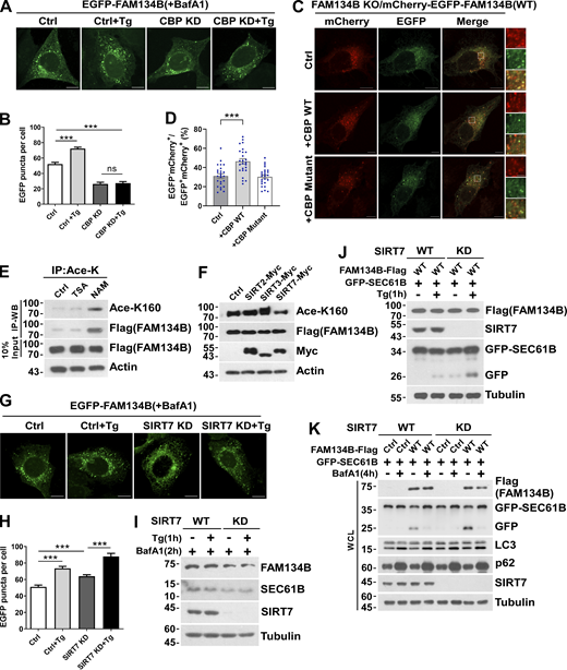 CBP and SIRT7 regulate FAM134B-mediated ER fragmentation and ER-phagy. (A and B) CBP KD attenuated FAM134B-mediated ER fragmentation. CBP WT or KD U2OS cells transiently expressing 0.2 µg EGFP-FAM134B (WT) were treated with Tg (1 μM) for 1 h or DMSO. Lysosomal degradation of EGFP-FAM134B was blocked by 10 nM BafA1 for 2 h. EGFP-positive puncta were quantified in B (n = 30 cells per group). Scale bars, 10 µm. Data are shown as means ± SEM and analyzed with one-way ANOVA. ***P < 0.001, ns means no significance. (C and D) CBP WT but not the catalytic activity-dead mutant enhanced FAM134B-mediated ER-phagy. FAM134B KO U2OS cells were engineered to inducibly express mCherry-EGFP-FAM134B (WT) at endogenous levels. CBP was transfected into cells. MCherry-positive but EGFP-negative puncta were quantified in D (n = 25 cells per group). Scale bars, 10 µm. The scale bars in the magnification boxes are 2 µm. Data are shown as means ± SEM and analyzed with one-way ANOVA. ***P < 0.001. (E) K160 acetylation of FAM134B in FAM134B-Flag stable cell line was increased by being treated with deacetylase inhibitor NAM (5 mM) for 12 h. IP was performed with an antibody to acetylated lysine. K160 acetylation and Flag were detected by Western blot (WB). (F) K160 acetylation accelerated by SIRT7. Myc-tagged Ctrl, SIRT2, SIRT3, or SIRT7 was expressed individually in FAM134B-Flag stable cell line. The indicated proteins were detected by Western blot. (G and H) SIRT7 KD enhanced FAM134B-mediated ER fragmentation. SIRT7 WT or KD U2OS cells transiently expressing 0.2 µg EGFP-FAM134B (WT) were treated with Tg (1 μM) for 1 h or DMSO. Lysosomal degradation of EGFP-FAM134B was blocked by 10 nM BafA1 for 2 h. EGFP-positive puncta were quantified in H (n = 30 cells per group). Scale bars, 10 µm. Data are shown as means ± SEM and analyzed with one-way ANOVA. ***P < 0.001. (I) Protein levels in G. SIRT7 WT and KD U2OS cells were treated with 1 μM of Tg for 1 h or DMSO. The indicated proteins were detected by Western blot. (J) Lysosomal cleavage of GFP was analyzed by Western blot in SIRT7 WT or KD cells transfected with 1.5 μg GFP-SEC61B and 0.5 μg FAM134B-Flag. Cells were treated with Tg (1 μM) for 1 h or DMSO. (K) Lysosomal cleavage of GFP was analyzed by Western blot in SIRT7 WT or KD cells transfected with 1.5 µg GFP-SEC61B and 0.5 µg FAM134B-Flag. Cells were treated with 10 nM BafA1 for 4 h or DMSO. Molecular weight measurements are in kD. Source data are available for this figure: SourceData FS3. Refer to the image caption for details.