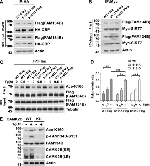 Inhibition of S151 phosphorylation does not affect K160 acetylation. (A) Measurement of interaction between HA-CBP and FAM134B (WT)-Flag, FAM134B (S151A)-Flag, and FAM134B (S151D)-Flag. IP was performed with anti-HA beads, which was followed by Western blot (WB) for FAM134B-Flag. (B) Measurement of interaction between Myc-SIRT7 and FAM134B (WT)-Flag, FAM134B (S151A)-Flag, and FAM134B (S151D)-Flag. IP was performed with anti-Myc magnetic beads, which was followed by Western blot for FAM134B-Flag. (C and D) K160 acetylation was not affected by expression of S151D mimicking permanent phosphorylation. HEK293T cells transfected with FAM134B (WT)-Flag, FAM134B (S151A)-Flag, and FAM134B (S151D)-Flag were treated with Tg (1 μM) for 0, 0.5, 1 h. IP was performed with anti-Flag beads, which was followed by Western blot for K160 acetylation. Quantification of K160 acetylation was shown in D (n = 3 experimental replicates). Data are shown as means ± SEM and analyzed with one-way ANOVA. **P < 0.01, ***P < 0.001, ns means no significance. (E) K160 acetylation was not affected by CAMK2B KD. CAMK2B WT or KD cells were treated with Tg (1 μM) for 1 h or DMSO. Cells were collected and analyzed for proteins as indicated by Western blot. Molecular weight measurements are in kD. Source data are available for this figure: SourceData FS4.