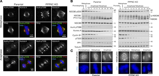 Timing of NDC80 phosphorylation during mitosis and mitotic exit. (A) Parental and PPP6C KO HeLa cells stained for Aurora A, the Aurora A activating protein TPX2, active Aurora A pT288, and DNA. Examples of metaphase and anaphase cells are shown. Arrowheads indicate the spread of active Aurora A on metaphase and anaphase spindles in PPP6C KO cells. Note the enlarged metaphase plate in PPP6C KO cells. (B) Synchronized parental and PPP6C KO HeLa cells in mitosis were treated with CDK inhibitor to promote entry into anaphase and mitotic exit. NDC80 phosphorylation was followed using NDC80 pS55 and Phos-tag gels. Mitotic exit was confirmed by blotting for cyclin B, the inhibitory pT320 modification of PP1, and active Aurora A pT288. (C) Parental and PPP6C KO HeLa cells stained for NDC80 pS55 and DNA. Examples of prometaphase, metaphase, and anaphase cells are shown corresponding to the conditions in B. Source data are available for this figure: SourceData F6. Refer to the image caption for details.