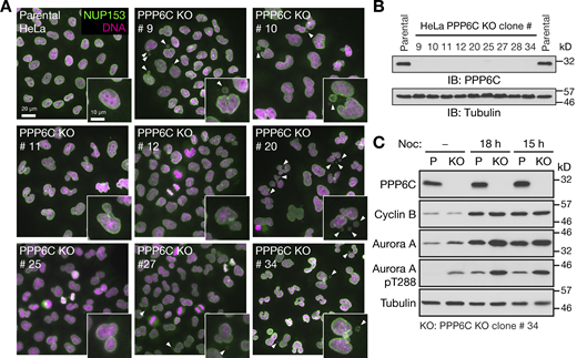 Characterization of PPP6C KO HeLa cell lines. (A) Parental and candidate PPP6C KO clones were stained for DNA and NUP153. Enlarged insets show examples of nuclear morphology in the parental cells and defects in the different KO clones. Arrowheads indicate micronuclei or nuclear morphology defects. (B) To confirm PPP6C was deleted, parental HeLa and the candidate PPP6C KO clones were Western blotted for PPP6C and tubulin as a loading control. (C) Parental and PPP6C KO clone#34 in asynchronous culture or arrested in mitosis for 15 or 18 h with nocodazole were Western blotted for PPP6C, cyclin B, Aurora A, and the activating pT288 phosphorylation on Aurora A. Tubulin was used as a loading control. Source data are available for this figure: SourceData FS1.