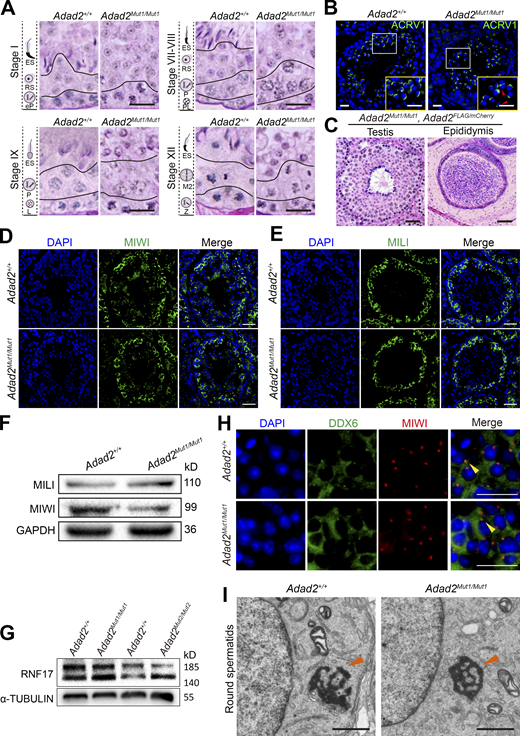 Loss of ADAD2 impairs spermatogenesis but not germ granule assembly in mice. (A) Representative images of PAS-staining histological testis sections in different stages of the seminiferous cycle from Adad2+/+ and Adad2Mut1/Mut1 mice are shown (n = 3), indicating round spermatid differentiation arrest. Scale bars = 20 μm. (B) Immunofluorescence analysis of proacrosomal vesicles visualized with antibodies to ACRV1 (green) in Adad2+/+ and Adad2Mut1/Mut1 round spermatids. DAPI (blue) marks the nuclei. Scale bar = 20 μm. Red arrowheads indicate defective acrosomes. (C) Representative images of PAS-staining histological testis and epididymis sections of adult Adad2Mut1/Mut1; Adad2Flag/mCherry mice are shown (n = 3). Scale bars = 50 μm. (D and E) Immunofluorescence staining with MIWI (D) and MILI (E) antibodies in seminiferous tubule sections of Adad2+/+ and Adad2Mut1/Mut1 mice. DAPI (blue) marks the nuclei. Scale bars = 50 μm. (F) Western blot analysis of MIWI and MILI in the whole testes of Adad2+/+ and Adad2Mut1/Mut1 mice. GAPDH was shown as a loading control. (G) Western blot analysis of RNF17 in the whole testes of Adad2+/+, Adad2Mut1/Mut1, and Adad2Mut2/Mut2 mice. α-TUBULIN was shown as a loading control. (H) Double immunostaining with DDX6 (green) and MIWI (red) on round spermatids from adult Adad2+/+ and Adad2Mut1/Mut1 testis sections are shown. DAPI (blue) marks the nuclei. Scale bar = 20 μm. Chromatoid bodies are marked with arrowheads. (I) Electron microscopic analysis of testis sections from adult Adad2+/+ and Adad2Mut1/Mut1 mice. Chromatoid bodies are marked with arrowheads. Scale bars = 1 μm. Source data are available for this figure: SourceData F5. Refer to the image caption for details.