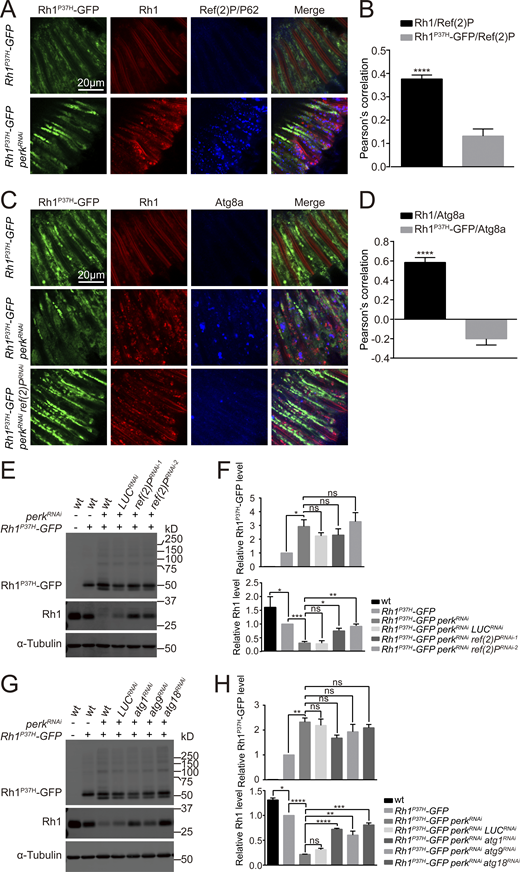 Wild-type Rh1 but not Rh1P37His degraded through autophagy. (A–D) Wild-type Rh1, but not Rh1P37H colocalized with Ref(2)P/P62 and Atg8a in Rh1P37H-GFP perkRNAi flies. (A) Longitudinal views of photoreceptor cells labeled for GFP (Rh1P37H-GFP, green), RFP (Rh1-RFP, red), and Ref(2)P/P62 (blue). Scale bar, 20 μm. (B) Quantification of the co-localization between Rh1P37H-GFP or Rh1-RFP and Ref(2)P/P62 in Rh1P37H-GFP perkRNAi photoreceptor cells. Error bars indicate SEM (n = 3); ****P < 0.0001 (Student’s unpaired t test). (C) Immune staining of photoreceptor cells against GFP (Rh1P37H-GFP, green), RFP (Rh1-RFP, red), and Atg8a (blue). Scale bar, 20 μm. (D) Quantification of the co-localization between Rh1P37H-GFP or Rh1-RFP and Atg8a in Rh1P37H-GFP perkRNAi photoreceptor cells. Error bars indicate SEM (n = 3); ****P < 0.0001 (Student’s unpaired t test). (E and F) Western blotting showed that knocking down ref(2)P/p62 significantly blocked the reduction of wild-type Rh1 without affecting the accumulation of Rh1P37H-GFP in Rh1P37H-GFP perkRNAi retina. Two independent ref(2)P/p62RNAi lines were used, and LUCRNAi was used as a control. Error bars indicate SEM (n = 3); ns, not significant, *P < 0.1, **P < 0.01, ***P < 0.001 (one-way ANOVA, Sidak’s multiple comparisons test). (G and H) Western blot analysis against Rh1P37H-GFP and endogenous Rh1 showed that atg1RNAi, atg9RNAi, and atg18RNAi suppressed perkRNAi-mediated decreases in wild-type Rh1 in Rh1P37H-GFP photoreceptor cells. Error bars indicate SEM (n = 3); ns, not significant, *P < 0.1, **P < 0.01, ***P < 0.001, ****P < 0.0001 (one-way ANOVA, Sidak’s multiple comparisons test). LUCRNAi was used as a control line, and α-tubulin was used as a loading control. 1-d-old flies of indicated genotypes were used. Source data are available for this figure: SourceData F6.