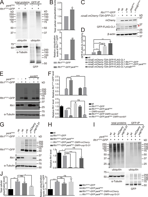 The ubiquitin-proteasomesystem (UPS) is impaired upon blocking PERK in adRP photoreceptors. (A) Accumulation of ubiquitinated proteins in Rh1P37H-GFP perkRNAi flies. Head lysate of Rh1P37H-GFP and Rh1P37H-GFP perkRNAi flies were immunoprecipitated with anti-GFP beads and stained against ubiquitin and GFP. (B) Quantification of total cellular ubiquitination levels (upper panel), and relative ubiquitination levels of Rh1P37H-GFP (lower panel) in A. Error bars indicate SEM (n = 3); *P < 0.1, **P < 0.01 (Student’s unpaired t test). (C) Western blotting against GFP and mCherry to examine proteasome activity in Rh1P37H-GFP perkRNAi flies. The ninaE promoter was used to drive mCherry-T2A-GFP-FLAG-Cl1 expression. Knock down of the proteasome subunit by prosβ1RNAi was used as a positive control. GFP-FLAG-CL1 protein is indicated by the red arrow. (D) Quantification of GFP-FLAG-CL1 and mCherry ratio in C. Error bars indicate SEM (n = 3); *P < 0.1, **P < 0.01 (one-way ANOVA, Sidak’s multiple comparisons test). (E and F) Western blot analysis showed that overexpression of SORDD1 in photoreceptor cells reduced Rh1P37H-GFP specifically upon loss of perk without affecting the Rh1 levels. Error bars indicate SEM (n = 3); ns, not significant, ***P < 0.001, ****P < 0.0001 (one-way ANOVA, Sidak’s multiple comparisons test). (G and H) Western blot analysis showed that USP15-31 restored Rh1 levels in Rh1P37H-GFP perkRNAi flies without affecting the levels of Rh1P37H-GFP. Error bars indicate SEM (n = 3); ns, not significant, *P < 0.1, ***P < 0.001 (one-way ANOVA, Sidak’s multiple comparisons test). (I) Overexpression of USP15-31 reduced the accumulation of ubiquitinated proteins in Rh1P37H-GFP perkRNAi flies, without affecting the ubiquitination levels of Rh1P37H-GFP. Head lysates of Rh1P37H-GFP, Rh1P37H-GFP perkRNAi, Rh1P37H-GFP perkRNAimCherry (GMR-Gal4/UAS-mCherry;UAS-perkRNAi/Rh1P37H-GFP) and Rh1P37H-GFP perkRNAiusp15-31 (GMR-Gal4/UAS-usp15-31;UAS-perkRNAi/Rh1P37H-GFP) flies were immunoprecipitated with anti-GFP beads and stained against ubiquitin and GFP. (J) Quantification of total cellular ubiquitinated proteins (left panel), and relative ubiquitination levels of Rh1P37H-GFP (right panel) in I. Error bars indicate SEM (n = 3); ns, not significant, *P < 0.1, **P < 0.01, ***P < 0.001 (one-way ANOVA, Sidak’s multiple comparisons test). 1-d-old flies of indicated genotypes were used. Source data are available for this figure: SourceData F7. Refer to the image caption for details.