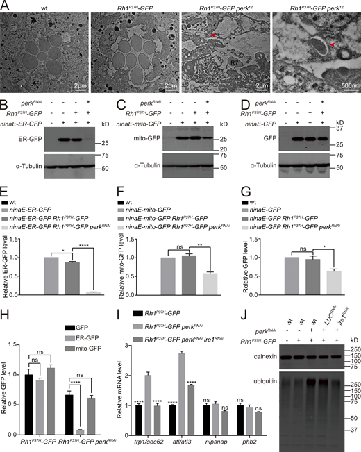 ER proteins were degraded through autophagy in Rh1P37H-GFP perkRNAiphotoreceptor cells. (A) TEM images of tangential sections of compound eyes from 5-d-old wt (w1118), Rh1P37H-GFP, and Rh1P37H-GFP perkRNAi flies. Autophagosome are indicated by red arrows. Scale bars, 2 μm and 500 nm. All flies were in white eye background and raised under 12 h light/12 h dark cycles. (B–H) Western blotting against GFP to examine the effects of perkRNAi on proteins with different subcellular localizations. ER-GFP was decreased in Rh1P37H-GFP perkRNAi flies, whereas Rh1P37H-GFP perkRNAi only slightly reduced mito-GFP and cytosolic GFP. Error bars indicate SEM (n = 6); ns, not significant, *P < 0.1, **P < 0.01, ****P < 0.0001 (one-way ANOVA, Sidak’s multiple comparisons test). 1-d-old flies of indicated genotypes were used. (I) qPCR analysis showed that mRNAs encoding fly homologs of mammalian ER-phagy receptors (trp1/sec62 and atl/atl3), but not homologs of mito-phagy receptors (nipsnap and phb2), were upregulated in the retina of Rh1P37H-GFP perkRNAi flies, compared with Rh1P37H-GFP and Rh1P37H-GFP perkRNAiire1RNAi retina. Error bars indicate SEM (n = 3); ns, not significant, ****P < 0.0001 (two-way ANOVA, Sidak’s multiple comparisons test). 1-d-old flies of indicated genotypes were used. (J) Accumulation of ubiquitinated proteins in membrane extracts of Rh1P37H-GFP perkRNAi flies. The membrane fraction was purified via centrifuge and labeled for ubiquitin and calnexin. Source data are available for this figure: SourceData FS4. Refer to the image caption for details.