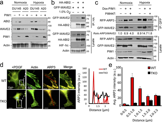 Hypoxia and PIM1 increase WRC levels and activation. (a) DU145 or ABI2-KOA20 cells stably expressing vector or PIM1 were cultured in normoxia or hypoxia (1.0% O2) for 16 h, and Western blotting was used to assess protein levels. (b) 293T cells were transfected with HA-ABI2 and GFP-WAVE2 and cultured in normoxia or hypoxia for 4 h. ABI2 was immunoprecipitated using anti-HA beads, and WAVE2 binding was assessed by Western blotting for GFP. (c) PC3-dox PIM1 cells were transfected with GFP-WAVE2 and RFP-ARP3. Then, cells were placed in normoxia or hypoxia and treated with dox (100 ng/ml) for 4 h in the presence of DMSO or PIM447 (3 µM). 5 min prior to harvest, all samples were stimulated with EGF (50 nM). WAVE2 was immunoprecipitated using the GFP tag, and ARP3 binding was assessed by Western blotting for RFP. (d) WT or TKO MEFs stably expressing GFP-Lifeact and RFP-ARP3 were starved for 4 h prior to stimulation with PDGF for 15 min. Cells were fixed for imaging, and ARP3 intensity was measured from the edge of cellular protrusions toward the center of the cell body (red dotted line). (e) Quantification of ARP3 intensity at given increments of distance from the leading edge (n > 15 cells/group). * P < 0.05 using two-sided Student’s t test, error = SEM. Scale bar = 20 µm for widefield images and 4 µm for insets. Source data are available for this figure: SourceData F4. Refer to the image caption for details.