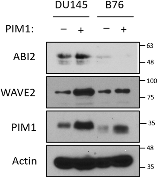 PIM1 increases WAVE2 levels in a ABI2-dependent manner. DU145 or ABI2-KOB76 cells stably expressing vector or PIM1 were cultured in normoxia for 16 h, and Western blotting was used to assess protein levels. Source data are available for this figure: SourceData FS3.