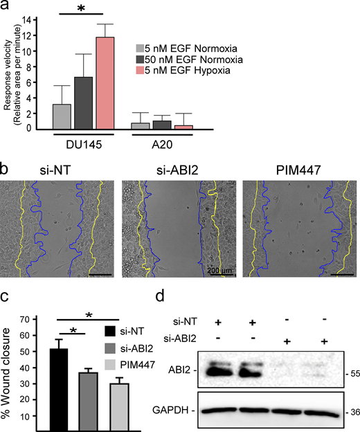 ABI2 and PIM are necessary for proper wound healing. (a) Quantification of the change in cell area per minute upon stimulation with EGF in different oxygen environments. Error = 95% CI (n = 45 5 nM EGF Nx; n = 15, 50 nM EGF Nx; and n = 15, 5 nM EGF Hx for DU145; n = 6 for ABI2-KOA20 in all conditions; *P < 0.05). (b) Wound healing assay with PC3-LN4 cells with a non-targeting siRNA, ABI2-targeting siRNA, or chemical inhibition of PIM. Cell edge at the time of scratch depicted in yellow and edge 8 h post-scratch in blue. Scale bar = 200 µm. (c) Quantification of the scratch assay. Error is SEM (n = 3; *P < 0.05). (d) Western blot depicting efficacy of siRNAs targeting ABI2 or non-specific sequence (negative control). Source data are available for this figure: SourceData FS4.