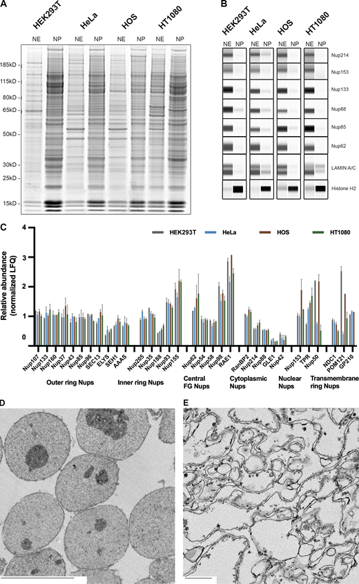 NE segregation from the nucleoplasm. (A) SDS-PAGE profile of the proteins in the NE and the nucleoplasm (NP) from different cell lines. Gel was stained with AquaStain. (B) Wes protein analysis of the NE and NP fractions. The fractions were blotted for different NPC proteins, Histone, and Lamin A/C. (C) Label-free MS analysis of the NE fractions from different cell lines. Proteins are organized according to their localization within the NPC. Error bars represent SD calculated using Microsoft Excel. (D) EM image of the nuclear fraction of HEK293T cells. Scale bar, 10 μm (E) EM image of the NE fraction of HEK293T cells. Scale bar, 600 nm. Source data are available for this figure: SourceData F3.