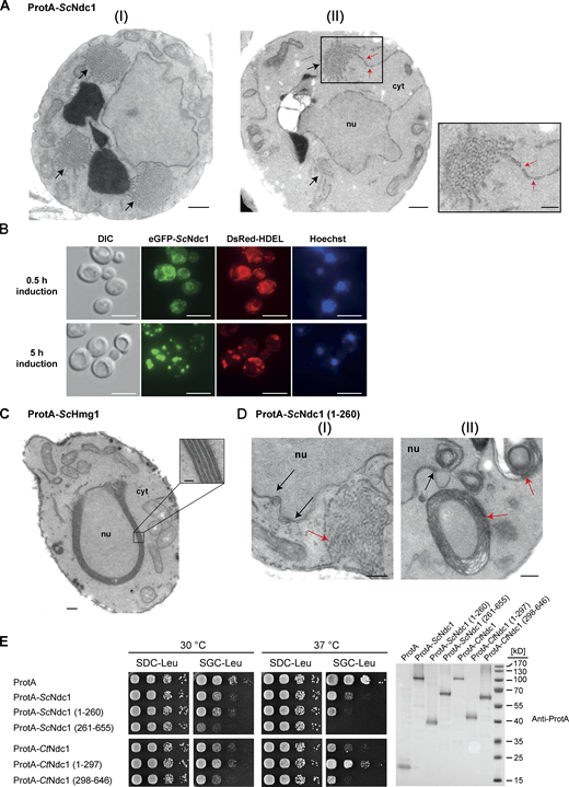 Overexpression of budding yeast Ndc1 or its N-terminal domain induces ER membrane expansion with pore-like structures. (A) Electron micrographs of WT yeast cells overexpressing ProtA-ScNdc1 showing the membrane proliferation. Cytoplasmic tubular membrane assemblies are marked with black arrows. Bars, 500 nm. ER-expansions with local membrane discontinuities (II), marked with red arrows, are magnified. Bars, 250 nm. (B) Fluorescence microscopy of cells overexpressing eGFP-Ndc1 for 0.5 or 5 h using DsRed-HDEL as an ER marker. Chromatin is stained with Hoechst 33258. Bars, 5 µm. (C) Electron micrograph of a WT yeast cell overexpressing ProtA-tagged 3-hydroxy-3-methylglutaryl-coenzymeA reductase 1 (ProtA-ScHmg1). The observed karmellae are shown at higher magnification (bars, 250 and 50 nm for the magnified panel). (D) Electron micrographs of yeast cells overexpressing the N-terminal part of ScNdc1 (ProtA-ScNdc1 (1-260)). Black arrows mark NE/ER proliferations, red arrows cytoplasmic membrane assemblies. Tubular membrane assemblies, similar to the ones observed upon overexpression of full-length Ndc1, are shown in I, karmellae-like multi-layered membrane whorls are shown in II. Bars, 250 nm. (E) Growth tests with yeast cells overexpressing ProtA-tagged full-length Ndc1 and Ndc1 truncations from both C. thermophilum and S. cerevisiae, ProtA-ScHmg1 or ProtA alone using LEU2 as selection marker. 10-fold serial dilutions of corresponding overnight cultures were spotted onto either glucose- (expression suppressing) or galactose- (expression inducing) containing plates lacking leucine (SDC-Leu or SGC-Leu) and incubated at 30 or 37°C for up to 3 d. For expression control, whole cell lysates were prepared from overnight cultures and analyzed by Western blotting. Source data are available for this figure: SourceData F3. Refer to the image caption for details.