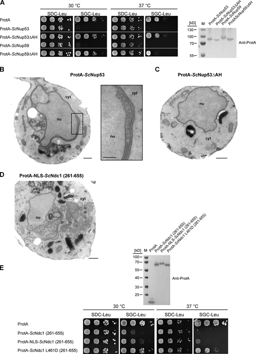 Nup53 or Nup59 overexpression-induced growth defects depend on their amphipathic helices. (A) Growth tests with cells overexpressing the linker nucleoporins Nup53 and Nup59 either non-mutated or mutated in their C-terminal amphipathic motifs. Growth and expression were analyzed as described earlier. (B) Electron micrograph of a yeast cell overexpressing ProtA-ScNup53; bar, 500 nm. Membrane sheets and tubules close to the INM are magnified (bar, 250 nm). (C) Electron micrograph of a yeast cell overexpressing ProtA-ScNup53ΔAH. Bar, 500 nm. (D) Electron micrograph of a yeast cell overexpressing ProtA-NLS-ScNdc1 (261-655) showing intranuclear vesicular membrane structures. Bar, 500 nm. (E) Growth tests with cells overexpressing the C-terminus of ScNdc1 N-terminally fused to the NLS sequence of the SV40 large T-antigen. Growth and expression were analyzed as described earlier. Source data are available for this figure: SourceData FS4. Refer to the image caption for details.