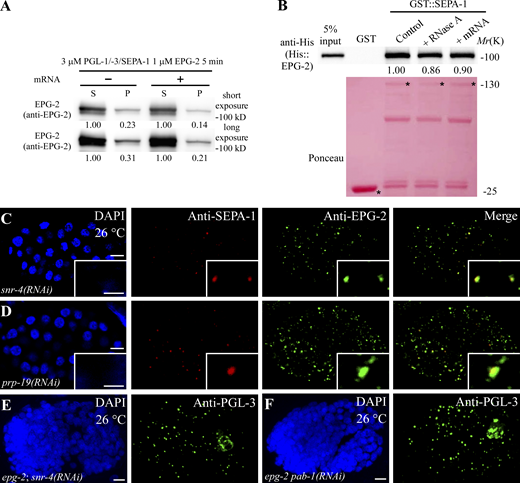 mRNA regulates the recruitment of EPG-2 to PGL granules, related toFig. 7. (A) Sedimentation assays showing that mRNA reduces the level of GFP::EPG-2 that partitions into condensates. (B) The direct interaction between SEPA-1 and EPG-2 is not evidently affected by RNase A treatment or the addition of 30 ng/μl mRNA in the reactions in the in vitro GST pull-down assay. Asterisks indicate bands with the expected molecular mass. The level of EPG-2 pulled down by GST::SEPA-1 was set to 1.0 in control conditions. (C and D) Compared with control embryos shown in (Fig. 7 D), the colocalization ratio of EPG-2 aggregates and PGL granules, detected by anti-SEPA-1, is increased in snr-4(RNAi) (C) and prp-19(RNAi) (D) embryos at 26°C. Embryos at the ∼100-cell stage are shown in C and D. (E and F) Compared to epg-2 mutant embryos shown in (Fig. 7 J), the number of PGL granules, detected by PGL-3 antibody, is reduced by simultaneous snr-4(RNAi) (E) and pab-1(RNAi) (F) at 26°C. Maximum-intensity projections of Z-stack confocal images of comma-stage embryos are shown in E and F. Scale bars: 5 µm for C–F; 2 µm for enlarged images in C and D. Source data are available for this figure: SourceData FS5.