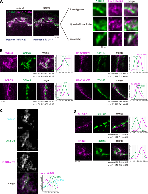 ACBD3 and C10orf76 localize at distinct subregions in the Golgi apparatus. (A) STED microscopy observation of ACBD3 and HA-C10orf76. The C10orf76 KO cells stably expressing HA-C10orf76 were immunostained with anti-ACBD3 and anti-HA antibodies and imaged using confocal or super-resolution STED microscopy. (B) STED microscopic observation of the intra-Golgi distribution patterns of ACBD3 and C10orf76. ACBD3 and HA-C10orf76 were co-stained with a cis-Golgi marker, GM130, or a TGN marker, TGN46. (C) GM130, ACBD3, and HA-C10orf76 were co-stained and observed under STED microscopy. (D) STED microscopic observation of the intra-Golgi distribution patterns of HA-CERT. The CERT KO cells stably expressing HA-CERT were immunostained with anti-HA + anti-GM130 antibodies or anti-HA + anti-TGN46 antibodies and imaged using STED microscopy. (B–D) Graphs represent the line profiles of ROIs (depicted by white lines): x-axis, distance; y-axis, normalized signal intensities. Scale bars, 1.0 µm. (B and D) The mean ± SD of Manders correlation coefficient (MCC) and the cell numbers (n) analyzed are shown. MCC M1 represents the colocalization rate of the protein of interest with the marker protein. M2 represents the colocalization rate of the marker protein with the protein of interest. Source data are available for this figure: SourceData F5.
