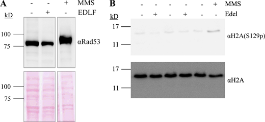 Edelfosine does not elicit a DNA damage response. (A) Anti-Rad53 Western blot of whole cell lysates from cells (W303) treated with edelfosine, vehicle or 0.01% MMS for 60 min. Bottom panel shows protein loading by Red Ponceau. (B) Anti-phospho-Ser129-H2A and anti-total H2A blot of whole cell lysate from cells expressing Sir4-13MYC or Heh1-13MYC treated with edelfosine, the vehicle or 0.01% MMS for 60 min. Source data are available for this figure: SourceData FS1.