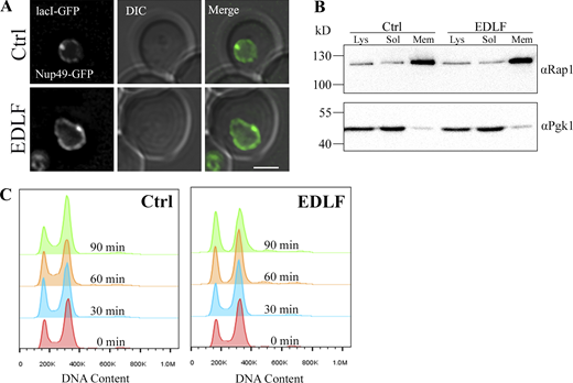 Telomere interactions with the nuclear membrane are preserved in edelfosine. (A) Representative cells expressing the Tel06R constructs quantified in Fig. 2 B were imaged using live fluorescence microscopy after 90 min in edelfosine or the vehicle. Scale bar represents 2 µm. (B) Membrane and soluble fractions were collected from BY4741 cells expressing Spt23-TAP treated with 20 μM edelfosine or vehicle for 60 min as described in Materials and methods, then blotted for detection of endogenous Rap1 and Pgk1. (C) Cell cycle analysis of wild-type cells (W303) treated with edelfosine or vehicle for the indicated times. For all panels: Ctrl = vehicle; EDLF = edelfosine. Source data are available for this figure: SourceData FS2.