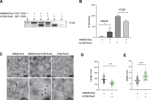 CGN Rod2 prevents NM2B Rod filament assembly. (A and B) SDS-PAGE analysis of supernatant (S) and pellet (P) fractions (A) and quantification of soluble supernatant fractions (B) for either purified NM2B Rod (1337–1976), or purified CGN Rod2 (667–1203), either alone or mixed together. Data in quantifications are represented as mean ± SD. Statistical significance was determined by unpaired Mann–Whitney’s test (*P ≤ 0.5; n = 7 experiments). (C) Electron microscopy analysis of negatively stained samples (top = low magnification, bottom = high magnification of insets) after dialysis of NM2B Rod alone (left panels), NM2B Rod + CGN Rod2 (middle panels), and CGN Rod2 alone (right panels). Arrows indicate compact ends of NM2B Rod filaments, arrowheads indicate frayed ends of NM2B Rod filaments in the presence of CGN Rod2. Scale bars = 100 nm. (D and E) Dot plots showing quantification NM2B C-terminal rod filament length and width in the absence (black dots) and in the presence (green dots) of CGN C-terminal rod fragment. Measurements were carried out on micrographs of negatively stained filaments (n = 200 filaments, Mann–Whitney test, two-tailed, ****P < 0.0001). Data in quantifications are represented as mean ± SD. Source data are available for this figure: SourceData F2. Refer to the image caption for details.