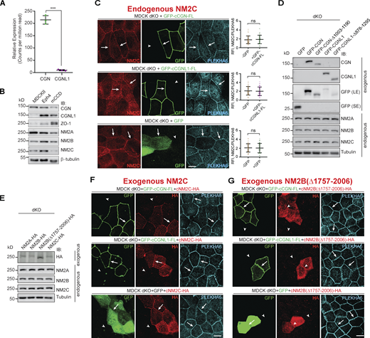 The junctional accumulation of NM2C is not promoted by CGN and CGNL1. (Related to Fig. 4.) (A) Levels of CGN and CGNL1 expression by RNASeq in MDCKII cells (n = 3). Data in quantifications are represented as mean ± SD, and statistical significance was determined by unpaired Mann–Whitney’s test. ***P ≤ 0.001. (B) IB analysis of lysates of MDCK cells, Eph4 cells, and mCCD cells using different antibodies against CGN, CGNL1, ZO-1, NM2A, NM2B, and NM2C. Antibody against β-tubulin was used as loading control. (C) IF microscopy analysis of the localization of endogenous NM2C in CGN-CGNL1 double-KO (dKO) MDCK cells, upon overexpression of GFP-tagged constructs of full-length (FL) CGN (top panel), full-length CGNL1 (middle panel), or GFP alone (bottom panel). Cells that overexpress exogenous constructs are shown in the same field as non-transfected cells, for direct comparison. Data in quantifications are represented as mean ± SD and statistical significance was determined by unpaired Mann–Whitney’s test (n = 48 junctions of two independent experiment). (D and E) IB analysis of lysates of MDCK dKO cells overexpressed CGN or CGNL1 or mutant tagged with GFP (D), or overexpressed NM2A or NM2B or NM2C or mutant (E), using the indicated antibodies. β-tubulin was used as loading control. Numbers on the left indicated migration of prestained markers. (F and G) IF microscopy localization of exogenous, full-length HA-tagged NM2A (F) and NM2B lacking the CGN/CGNL1 binding region (NM2BΔ1757-2006; G) in CGN/CGNL1 double-KO cells expressing either GFP-tagged full-length CGN (top panels), or GFP-tagged full-length CGNL1 (middle panels), or GFP alone (bottom panels). Arrows indicate junctional localization and arrowheads reduced/undetected junctional localization. PLEKHA6 labeling is used as a reference junctional labeling. Scale bars, 10 μm. Source data are available for this figure: SourceData FS3.