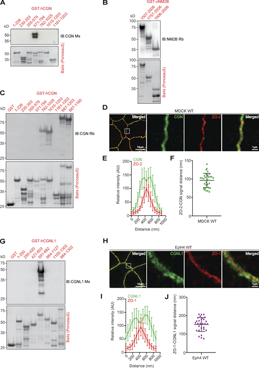 Mapping of antibody-binding regions and calculated distances between CGN and CGNL1 and ZO proteins. (Related to Fig. 5.) (A–C and G) IB analysis (top panels) and Ponceau-S labeling (bottom panels) of bacterially expressed GST-fusion protein fragments of CGN (A and C), NM2B (B), and CGNL1 (G) using the indicated antibodies, to map the antibody epitopes. (D–F and H–J) IF microscopy analysis of the localization of endogenous CGN in MDCK WT cells (D) and CGNL1 in EpH4 WT cells (H). High magnification panels correspond to highlighted white box in low magnification micrograph; scale bars = 10 μm (low magnification) and 1 μm (high magnification) for (D) and (H). (E, F, I, and J) Linescan analysis of signal distribution (E and I) and box plots of distances of CGN signal from ZO-2 signal (F) and CGNL1 signal from ZO-1 signal (J). For E, F, I, and J, n = 24 from two independent experiments, and data in quantifications are represented as mean ± SD. Source data are available for this figure: SourceData FS4.