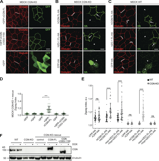 TJ membrane tortuosity is regulated by CGN interaction with NM2B. (Related to Figs. 8 and 9.) (A and D) IF microscopy localization of endogenous occludin and GFP-tagged exogenous CGN constructs (A) and quantification of ZI (D) in CGN-KO MDCK cells. Cells were rescued with either full-length (FL) CGN (top panel), or CGN lacking the NM2BR (middle panel), or GFP alone (bottom panel, negative control). Lines in occludin channel trace membranes to highlight tortuosity. Data are represented as mean ± SD (n = 67–80 from three independent experiments). Statistical significance was determined by unpaired Mann–Whitney test, ***P < 0.001. (B, C, and E) IF microscopy localization (B and C) of endogenous occludin in either CGN-KO (B) or WT (C) MDCK cells overexpressing either HA-tagged CGN (top panels), or HA-tagged ZO-1 (middle panels), or HA-CFP (bottom panels, negative control) and quantification of ZI (E). Dots in E show replicates (n = 45 junctional segments from three independent experiments), and data are represented as mean ± SD. Statistical significance was determined by unpaired Mann–Whitney test, ****P < 0.0001. Scale bars (A–C), 10 μm. (F) IB analysis of the expression of endogenous and exogenous CGN constructs (either CGN-FL orCGN-Δ1003-1190) either in WT MDCK cells, or CGN-KO cells, or CGN-KO cells inducibly rescued with the indicated constructs for the measurement of apical membrane stiffness (Fig. 9). Source data are available for this figure: SourceData FS7.