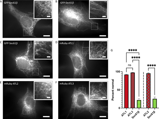 Human ATL3 can maintain the ER network in ATL1/2/3 KO cells. (A–F) NIH 3T3 parental (A) or triple ATL1/2/3 KO E5 cells (B–F) were transfected with GFP-Sec61β (A–C), mRuby-ATL1 (D), mRuby-ATL2 (E), or mRuby-ATL3 (F). 48 h later, cells were fixed and visualized by confocal microscopy; scale bar, 10 µm. Also shown are magnified insets of the boxed area within each image; scale bar, 2 µm. (G) The percent cells expressing the indicated proteins that had a normal branched ER network morphology ± SD, n = 3 independent experiments, an average of 44 cells per experiment. Quantification for analysis of ATL1 and ATL3 with respect to Sec61β (left) was blinded, and quantification of analysis of ATL2 with respect to Sec61β (right) was done separately without blinding. ns, P > 0.05; ****, P < 0.0001 as determined by one-way ANOVA analysis (ATL1/ATL3/Sec61β) or unpaired t test (ATL2/Sec61β). Source data are available for this figure: SourceData F2.