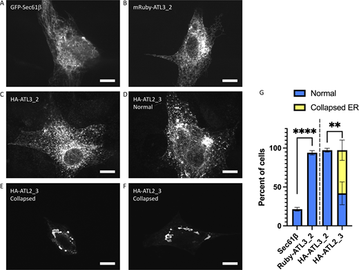 ATL3_2 and ATL2_3 chimera are functional in ATL1/2/3 KO E5 cells. (A–F) National Institutes of Health 3T3 triple ATL1/2/3 KO E5 cells were transfected with GFP-Sec61β (A), mRuby-ATL3_2 (B), HA-ATL3_2 (C), or HA-ATL2_3 (D–F). 48 h later, cells were fixed and visualized directly by confocal microscopy (A and B) or visualized after immunostaining with anti-HA antibodies (C–F); scale bar, 10 µm. (G) The percent cells expressing the indicated proteins that had a normal branched ER network or collapsed ER morphology ± SD, n = 3 independent experiments, an average of 20 cells per experiment. Ruby-ATL3_2 and Sec61β (left) was performed separately from the HA-ATL3_2 and HA-ATL2_3 (right) experiments and analyzed separately. All analysis was performed without blinding. ****, P < 0.0001; **, P = 0.0030 as determined by unpaired t tests (Ruby-ATL3_2/Sec61β; HA-ATL3_2/HA-ATL2_3) comparing percent cells with normal ER morphology. Source data are available for this figure: SourceData FS2. Refer to the image caption for details.