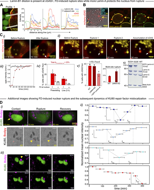 Nuclear rupture by small FDs depends on lamin-A levels. (A) Additional examples of FD-induced nuclear rupture with the FD colocalizing with Lamin-B1 depletion and accumulation of mCherry-cGAS. One line profile goes through the indentation-rupture site, and the second profile goes through the non-ruptured site. Line profiles show at rupture sites that both cGAS and DNA are more dense, whereas Lamin-B1 is depleted (n = 3 nuclei). (B) GFP-Lamin-A transduced U2OS cells show accumulation at a rupture site (arrow) but dilution at a non-rupture site of FD-indentation at the opposite pole; Lamin-B1 dilutes at both sites of FD-induced indentation (representative of n = 3 cells). (C) Additional live imaging examples of FD-induced nuclear rupture (per Fig. 2 A). (C i) After contact with an FD, the top of a nucleus is ruptured and begins to accumulate cGAS (arrow). (C ii) cGAS foci arise at two distinct nuclear sites within the same nucleus, and both foci appear at regions that are in close proximity to small diameter FDs (arrows). (C iii) Spatiotemporal kinetics of cGAS illustrates accumulation of cGAS around an FD contact site by 10 min that lasts for hours. (C iv) At the start of live imaging (t = 0) and during live imaging, nearly all rupture events show an FD in close proximity to a cGAS scar. (C v) Knockdown (KD) of Lamin-A (LMNA) showed increased multi-site rupture by FDs (duplicates, n = 200), whereas Lamin-A overexpression suppressed the frequency of nuclear rupture (duplicates, n = 120 cells). Immunoblot for Lamin-A,C indicates the overexpression level of GFP–Lamin-A in transduced U2OS relative to B-actin. (D i) Additional live imaging examples of KU80 mislocalization (per Fig. 2 C) after FD-nuclear contact (arrows or arrowheads) followed by slow recovery over 2–3 h. (D ii) Large FDs impose low curvature on the nucleus and do not trigger nuclear rupture with KU80 mislocalization, despite deep indentations. (D iii) Kinetics (20 min bins) of KU80 mislocalization for rupturing nuclei during live imaging (*, P < 0.05). Source data are available for this figure: SourceData FS2.