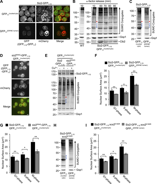 Constitutive association of Siz2 with the NE induces SUMOylation and increases nuclear surface area. (A) WT cells producing Siz2-GFP1-10 and a plasmid-encoded GFP11-mCherry-TM (GFP11(nucleo/cyto)) or mCherry-TM-GFP11 (GFP11(NE/ER lumen)) fusion protein were examined by epifluorescence microscopy. The membrane-integrated GFP11 fusion proteins allow for the visualization of NE/ER morphology by mCherry fluorescence. Formation of GFP1-10-GFP11 dimers was visualized by GFP fluorescence. Arrowheads point to GFP fluorescence at the NE in several cells. Size bar, 2 µm. (B) WT cells or cells producing Siz2-GFP1-10 and GFP11-mCherry-TM (GFP11(nucleo/cyto)) were arrested in G1-phase using α-factor, released from arrest, and then analyzed every 10 min by Western blotting to detect SUMO conjugates, Clb2, and the Gsp1 load control. Clb2 levels peak in mitosis. Note, Western blot images of samples from the Siz2-GFP1-10/GFP11 strain were derived from the same blot. (C and H) SUMO conjugate profiles of the indicated strains were assessed by Western blotting of cell lysates derived from asynchronous cultures. Images shown were derived from the same Western blot. (D)siz2Δ mutant cells containing plasmid-encoded GFP11-mCherry-TM (GFP11(nucleo/cyto)) and a plasmid expressing the siz2RING-GFP1-10 mutant from a copper-inducible promoter were examined by epifluorescence microscopy 4 h after 0.5 mM Cu2+ addition. GFP and mCherry fluorescence was visualized as described in A. Arrowheads point to GFP fluorescence at the NE in several cells. Size bars, 2 µm. (E) Cultures of cells producing Siz2-GFP1-10 and plasmid-encoded GFP11-mCherry-TM (GFP11(nucleo/cyto)) and siz2Δ mutant cells producing plasmid-encoded siz2RING-GFP1-10 and GFP11-mCherry-TM (GFP11(nucleo/cyto)) (described in D) were incubated in the presence or absence of 0.5 mM Cu2+ for 4 h. SUMO conjugates and the GFP1-10 fusions were detected by Western blotting. Note, following induction, the CUP1pr-siz2RING-GFP1-10 gene produced levels of siz2RING-GFP1-10 similar to Siz2-GFP1-10. (F and I) Nuclear surface areas of WT (F) and scs2K180R mutant (I) cells expressing the specified constructs at the indicated cell cycle stage were determined using Pus1-GFP as described in Fig. 1 A. (G) Pus1-GFP was introduced into the two strains described in E and nuclear surface areas of cells were examined after Cu2+ induction. Note, arrowheads on Western blots in B, C, E, and H point to SUMOylated Scs2 (red) and/or three prominent Siz2-dependent INM SUMO conjugates (blue; Ptak et al., 2021). Mass markers are shown in kilodaltons. Error bars for all graphs shown are SD, and p values were determined using a two-tailed Student’s t test for the indicated sample pairs. *p ≤ 0.05, **p ≤ 0.01. Source data are available for this figure: SourceData F2. Refer to the image caption for details.