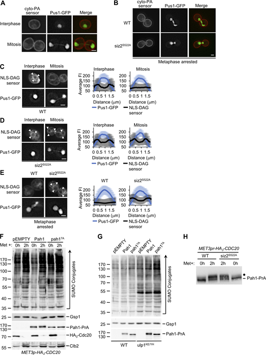 Cellular distribution of PA and DAG in WT and siz2S522Amutant cells. (A) Asynchronous cultures of WT cells producing Pus1-GFP and the cytoplasmic (cyto)-PA sensor protein (Opi1(Q2)-mCherry; Romanauska and Köhler, 2018) were examined by epifluorescence microscopy. Representative images of interphase and mitotic cells from actively growing cultures are shown. Size bar, 2 µm. (B) WT and siz2S522A mutant cells containing MET3pr-HA3-CDC20 and producing Pus1-GFP and the cyto-PA sensor were arrested in metaphase, and the distribution of the cyto-PA sensor was examined. Representative images are shown. Size bar, 2 µm. (C–E) WT (C) and siz2S522A mutant (D) cells producing Pus1-GFP and the NLS-DAG-sensor protein (PKCβ(C1a+C1B)-mCherry; Romanauska and Köhler, 2018) were examined by epifluorescence microscopy. Representative images of interphase and mitotic cells from actively growing cultures are shown. In E, WT and siz2S522A mutant cells containing MET3pr-HA3-CDC20 and producing Pus1-GFP and the NLS-DAG-sensor protein were arrested in metaphase by methionine addition. Images show the distribution of the NLS-DAG sensor protein and nuclear Pus1-GFP at 2 h after methionine addition. In C–E, the line scan intensities of the NLS-DAG sensor protein (mCherry) and Pus1-GFP were obtained as described in the Fig. 3 A legend for the indicated strains. Error bars are SD. Arrowheads highlight the NLS-DAG sensor protein along the INM. Size bar, 2 µm. (F) Cell lysates derived from asynchronous (0 h) or metaphase-arrested (2 h after methionine addition) cultures of indicated strains were analyzed by Western blotting to assess SUMO conjugate profiles. (G) Cell lysates derived from asynchronous cultures of the indicated strains were assessed by Western blotting using an anti-SUMO antibody to visualize SUMO conjugate profiles. Gsp1 is a loading control. (H) Asynchronous (0 h) or metaphase-arrested (2 h) cultures of WT and siz2S522A mutant cells containing the MET3pr-HA3-CDC20 cassette and expressing PAH1-PrA were prepared as described in the Fig. S1 legend. Cell lysates were analyzed by Western blotting to detect Pah1-PrA. The position of phosphorylated forms of Pah1-PrA is indicated by a dot. Mass markers are shown in kilodaltons. Source data are available for this figure: SourceData FS3. Refer to the image caption for details.